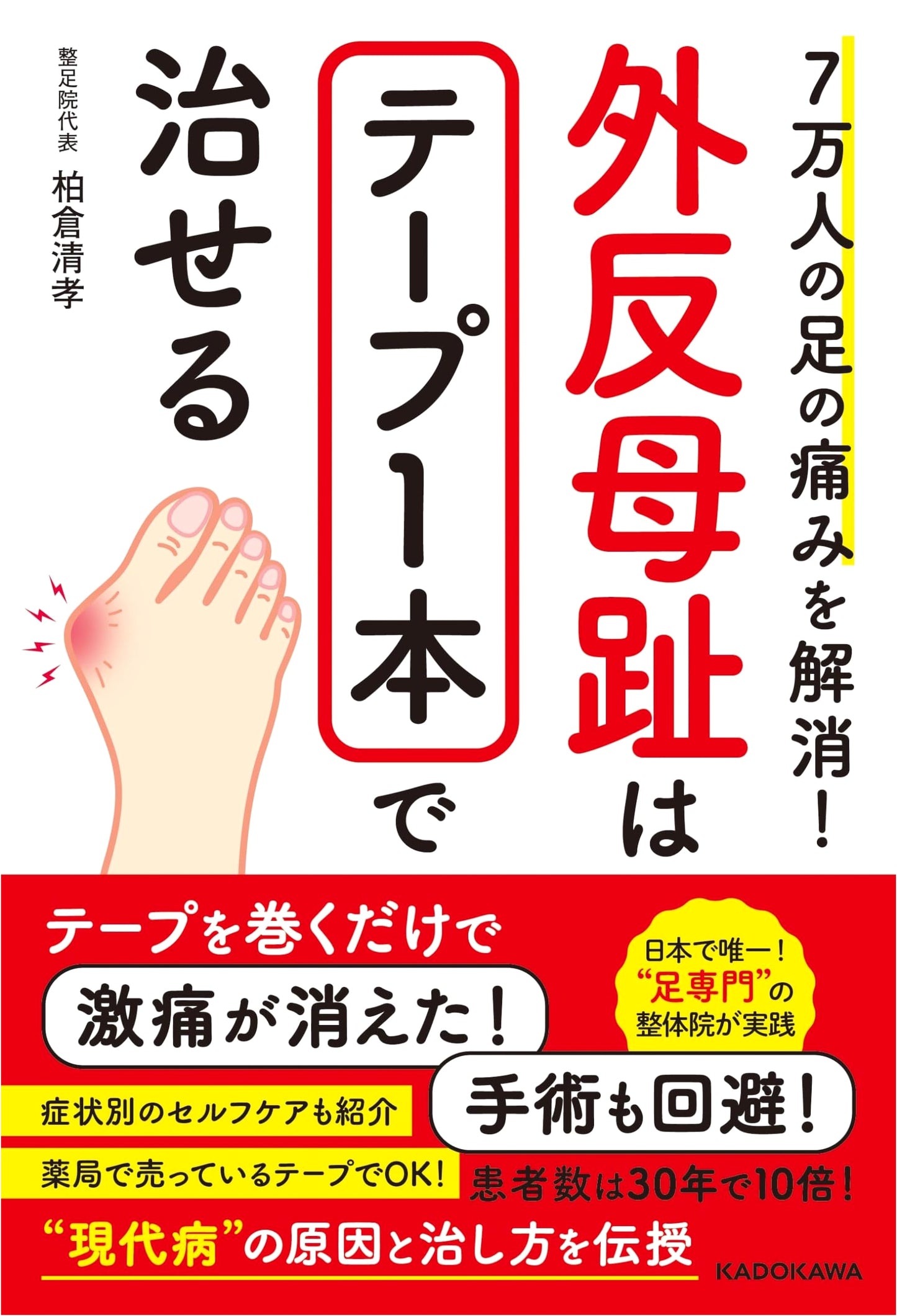 Cure Hallux Valgus (Bunions) with Tape: Relief for 70,000 People by Kiyotaka Kashikura