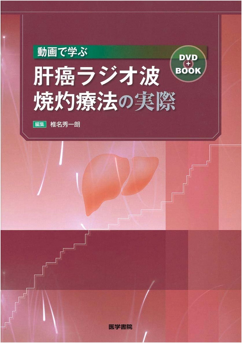 Liver Cancer Radiofrequency Ablation: A Practical Video Guide (DVD+Book)