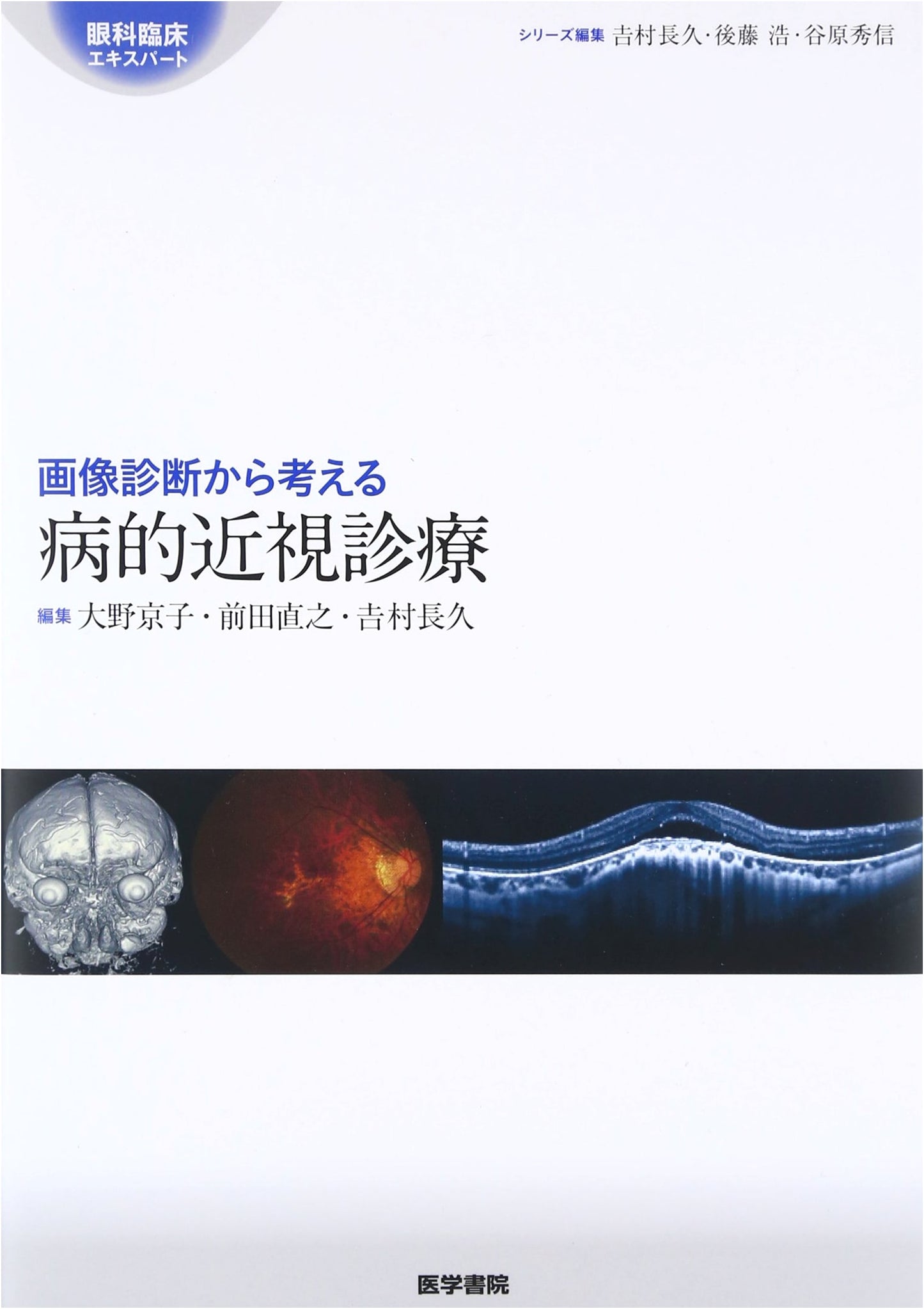 Pathological Myopia Management: Insights from Diagnostic Imaging (Ophthalmic Clinical Expert)
