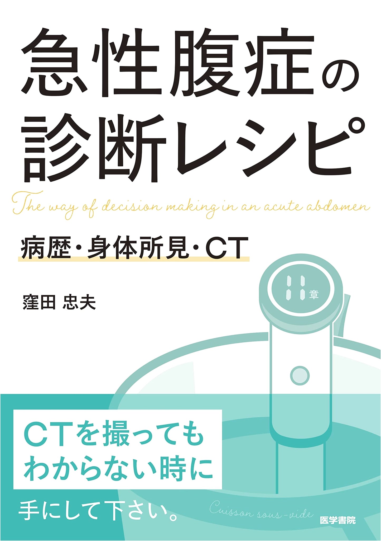 Diagnostic Recipes for Acute Abdomen: History, Physical Exam, and CT Scans