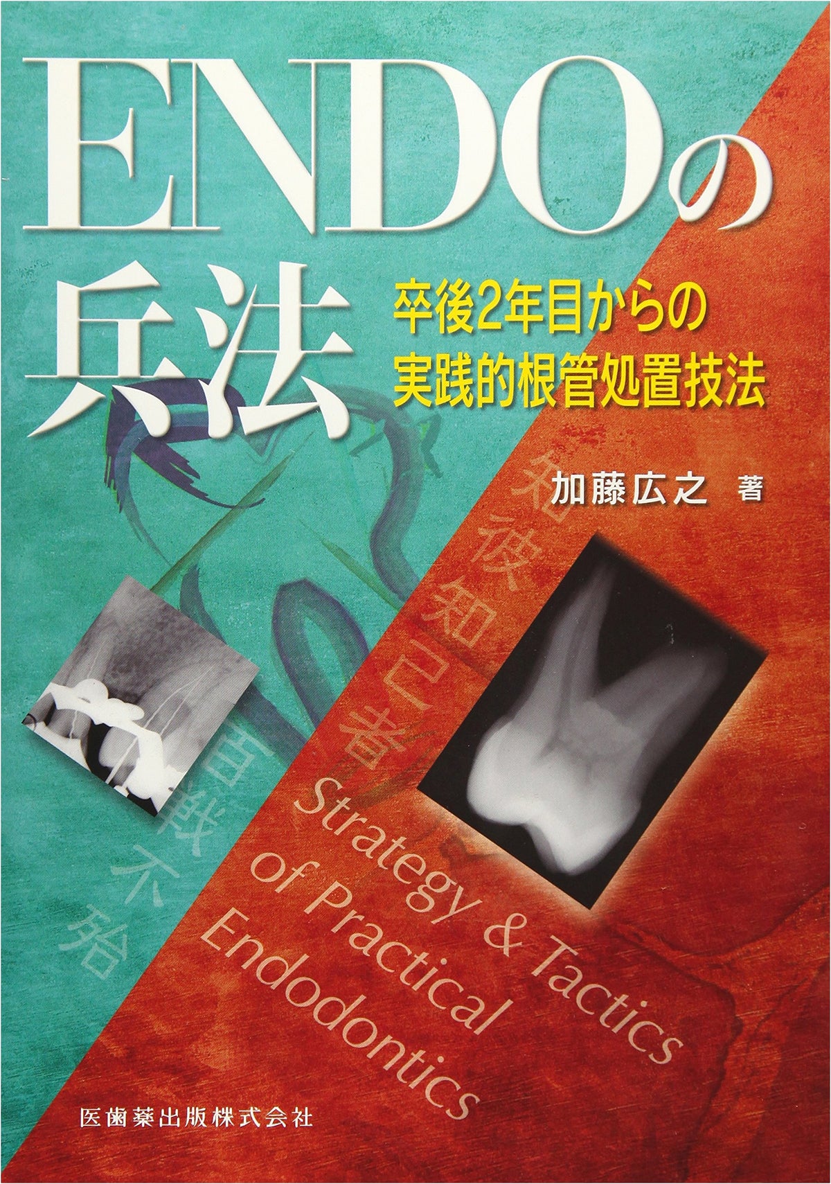 ENDO's Art of War: Practical Root Canal Treatment Techniques from Year 2 Post-Graduation