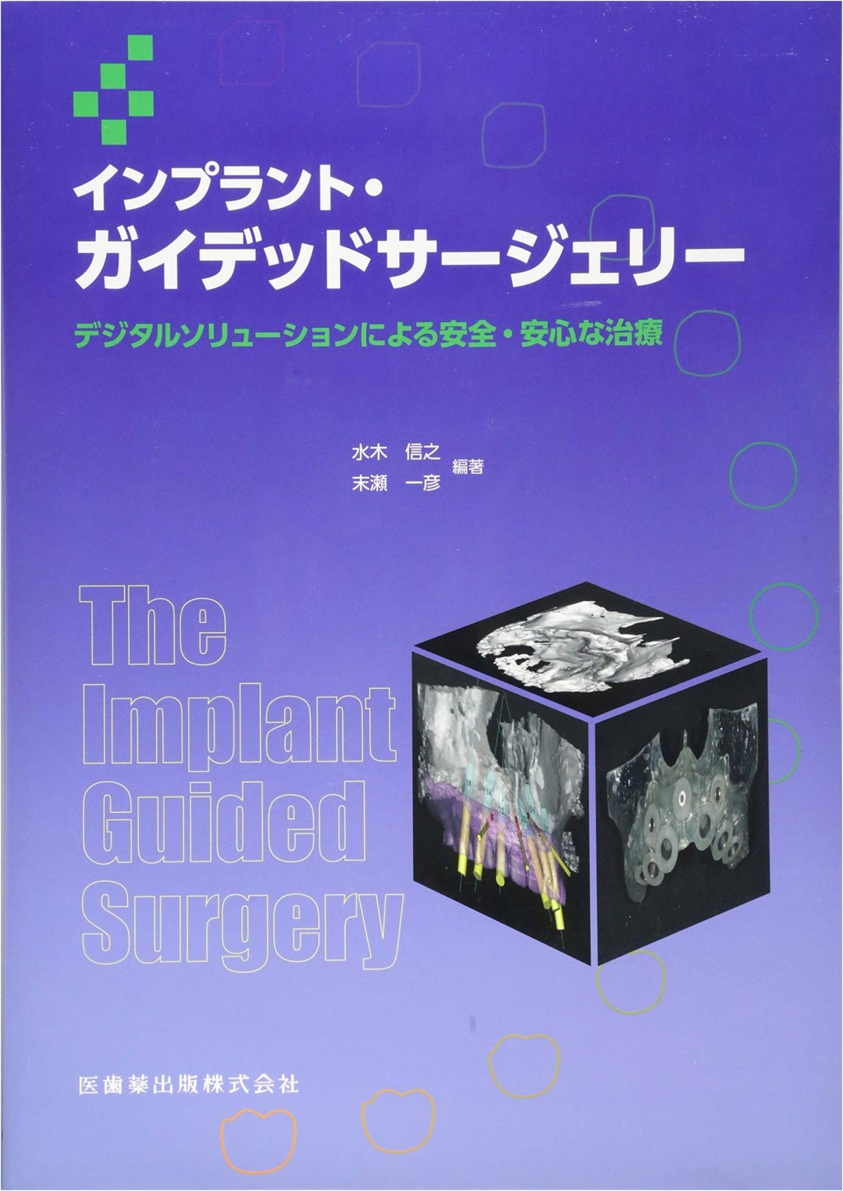Implant Guided Surgery: Safe & Secure Treatment with Digital Solutions