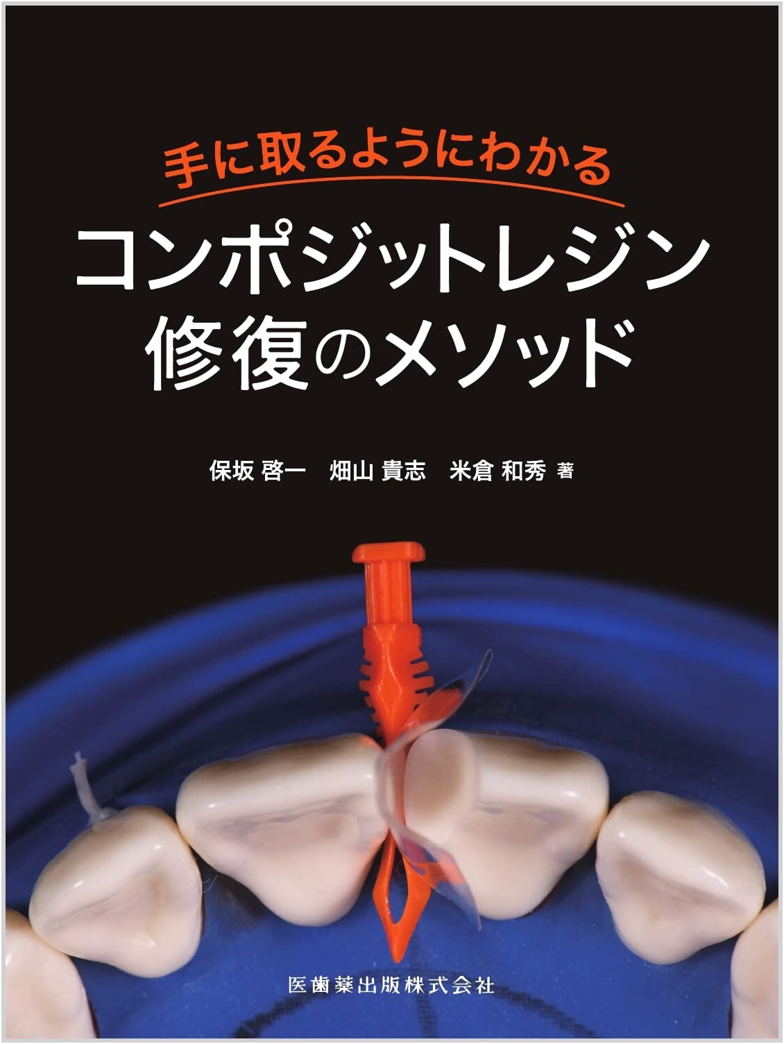 Composite Resin Restoration Methods: An Easy-to-Understand Guide