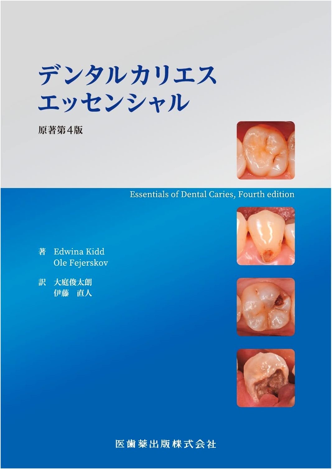 Essential Dental Caries: Original 4th Edition
