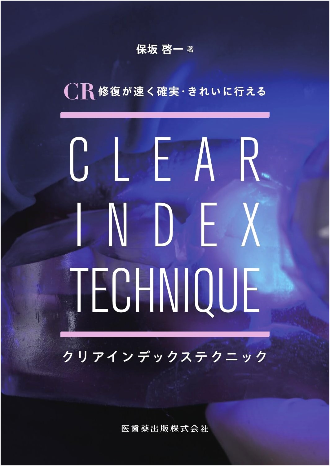 Clear Index Technique for Fast, Reliable, and Beautiful CR Restorations