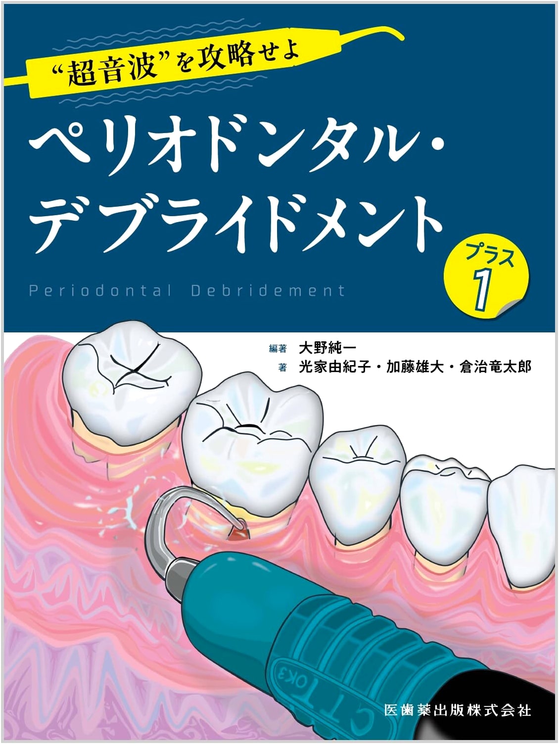 Mastering Ultrasonics: Periodontal Debridement Plus One (Unknown Author)