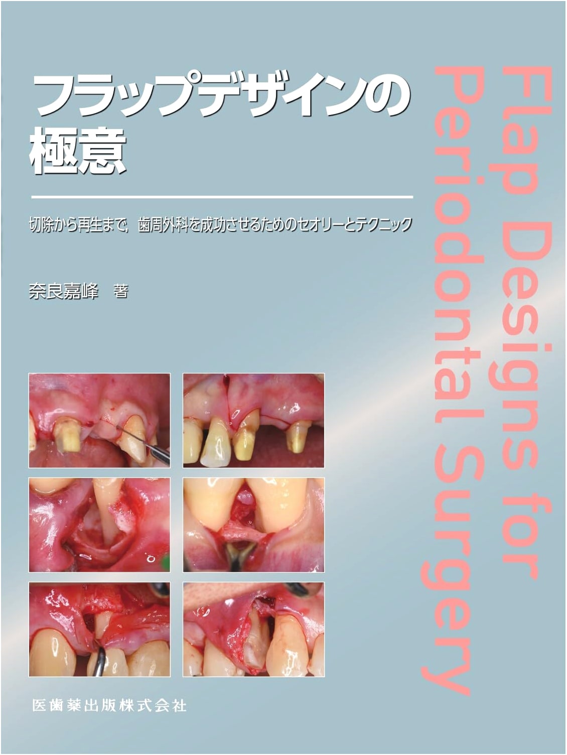 Secrets of Flap Design: Theory & Techniques for Successful Periodontal Surgery
