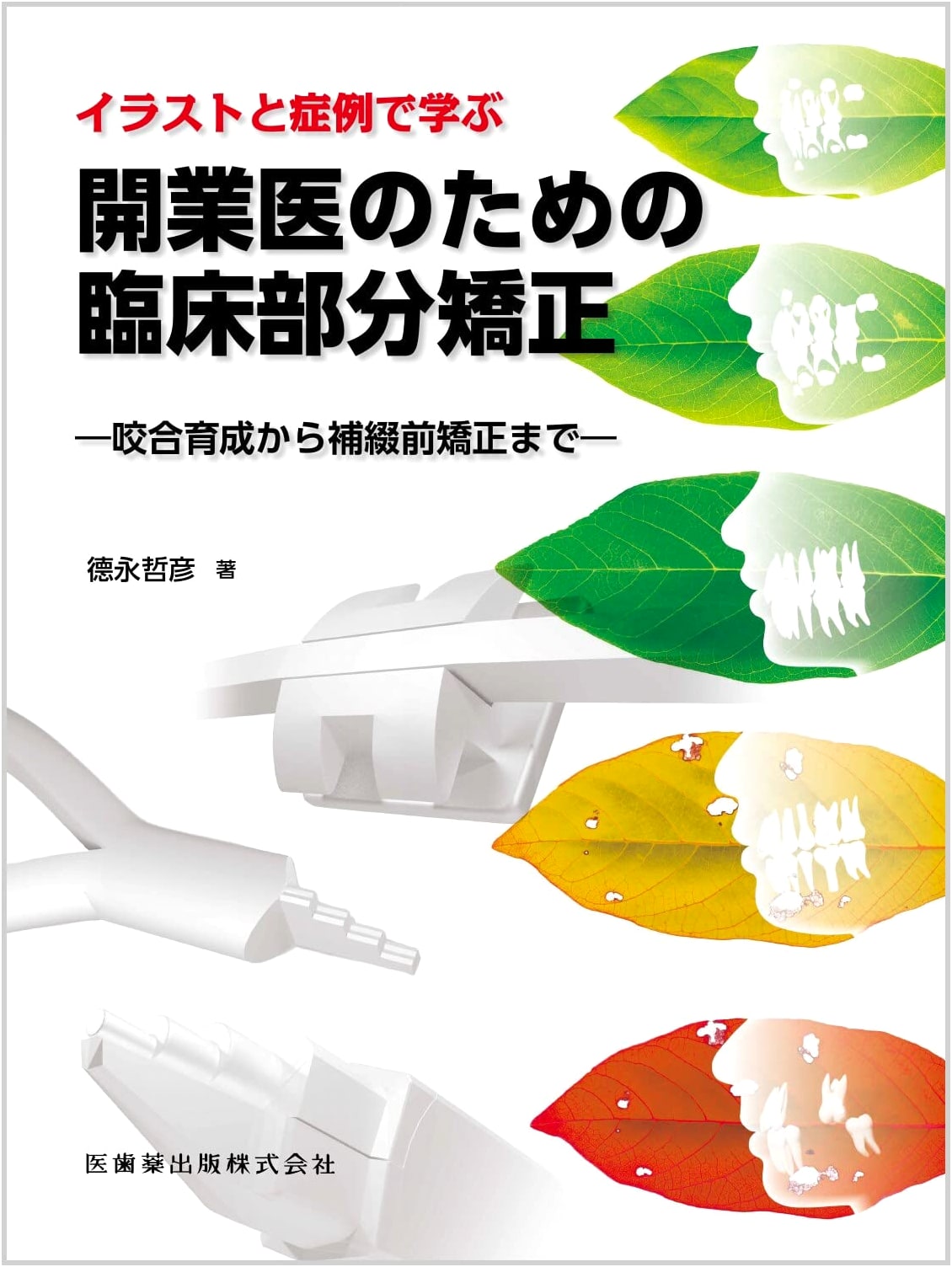 Clinical Partial Orthodontics for Clinicians: Illustrated Cases, Occlusal Guidance to Pre-Prosthetic Care