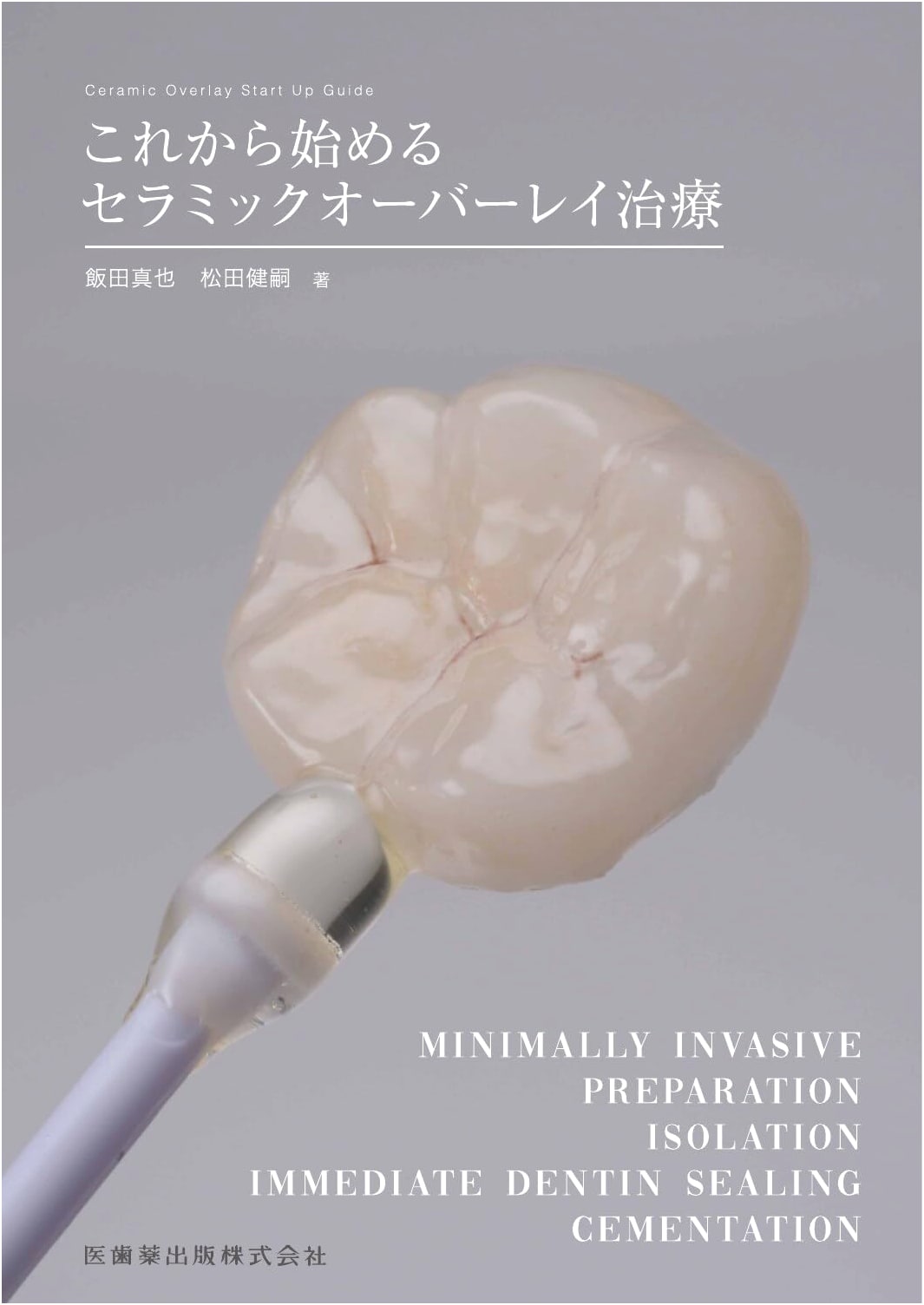 Introduction to Ceramic Overlay Treatment