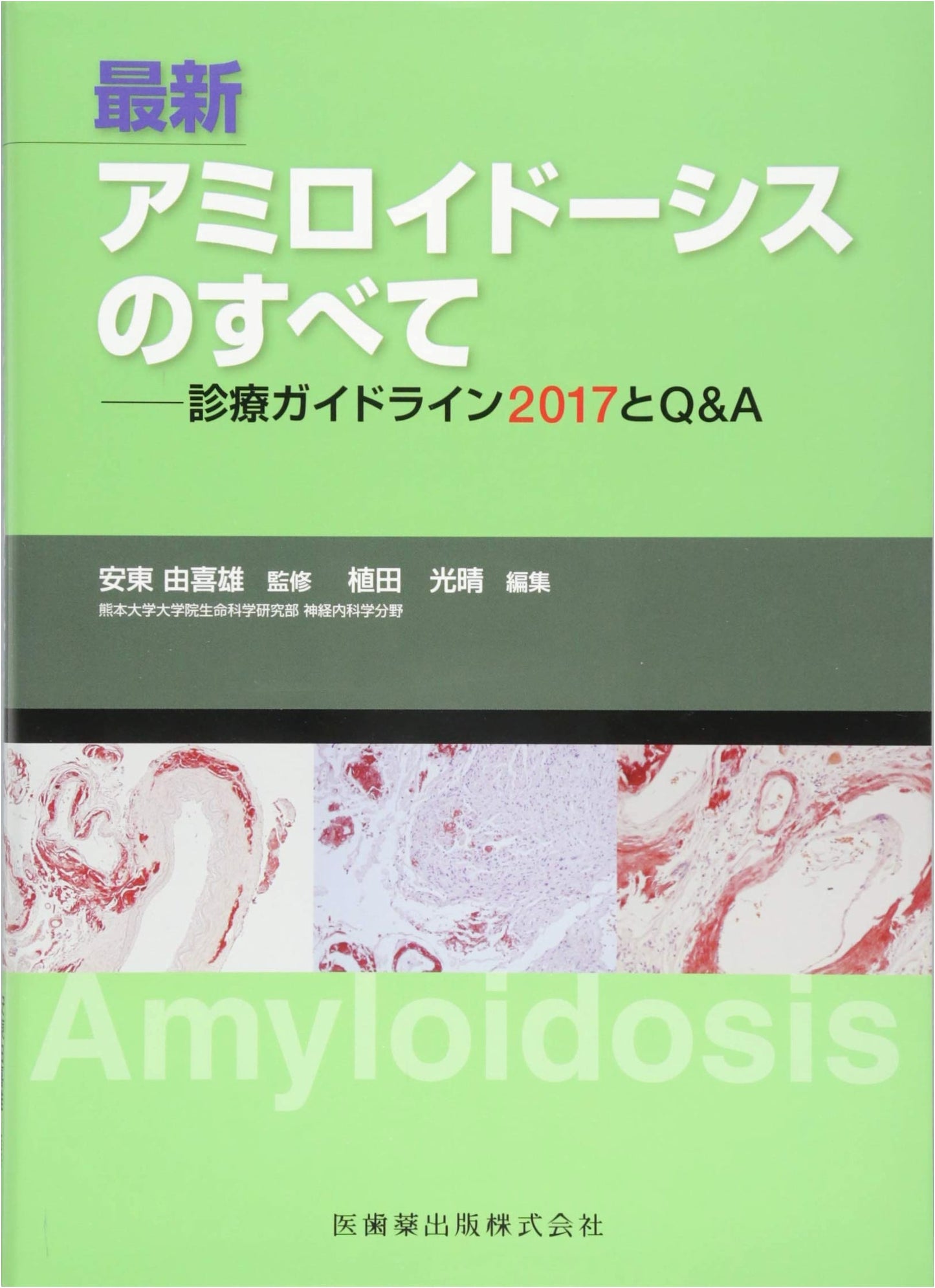 Latest Amyloidosis: Everything About Clinical Guidelines 2017 & Q&A
