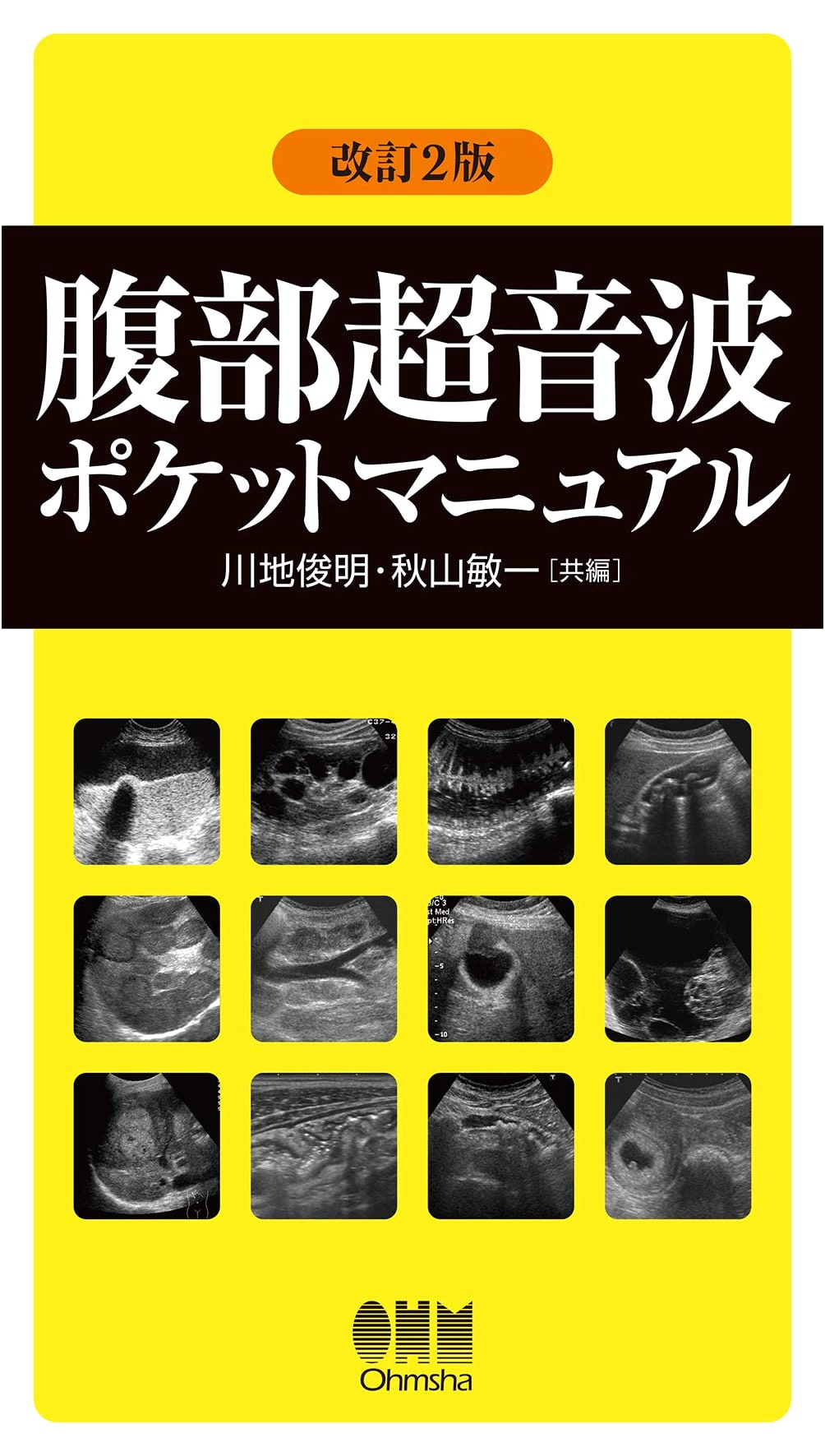 Abdominal Ultrasound Pocket Manual (Revised 2nd Edition)