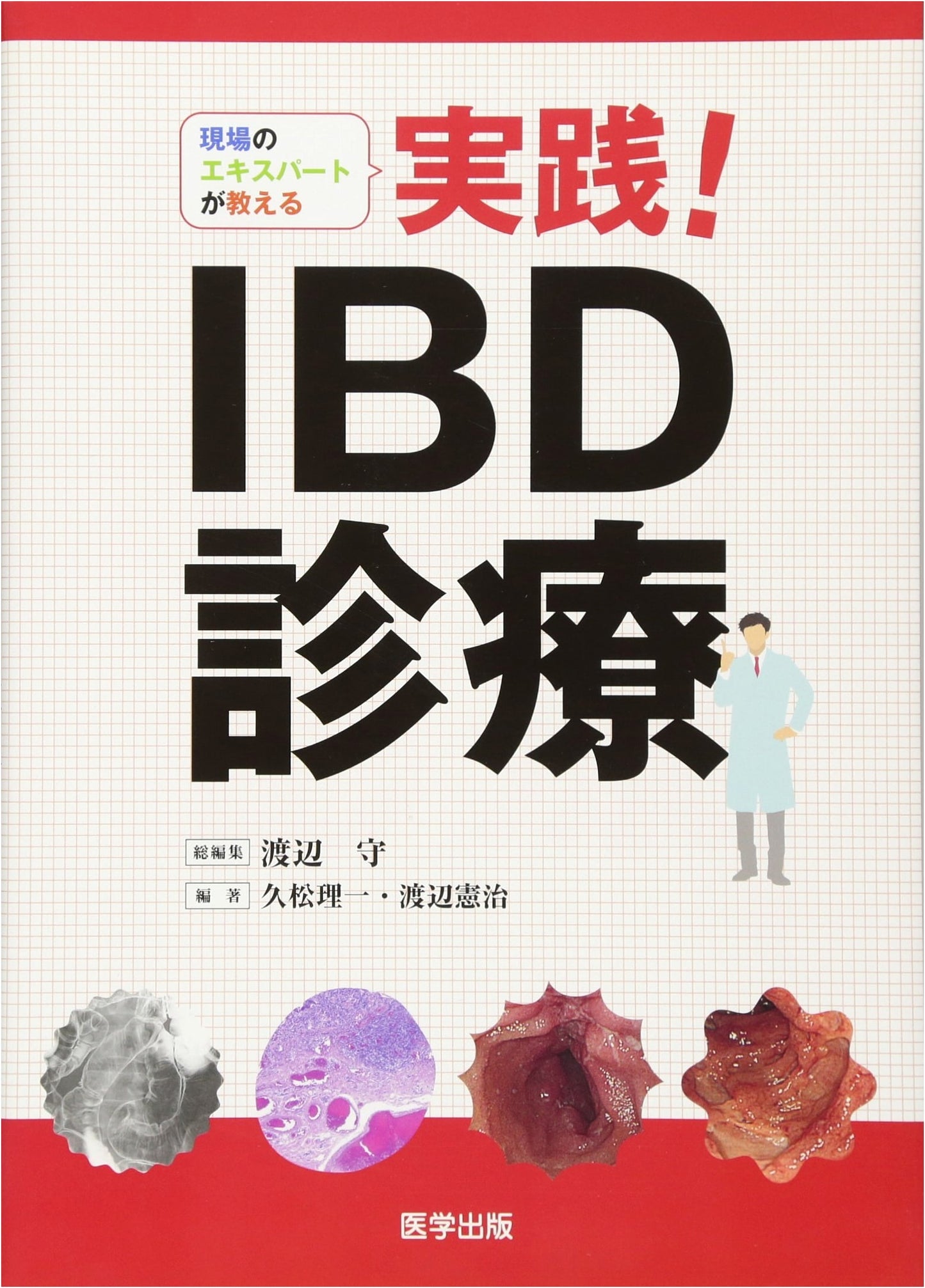 Practical IBD Treatment: Insights from Frontline Experts