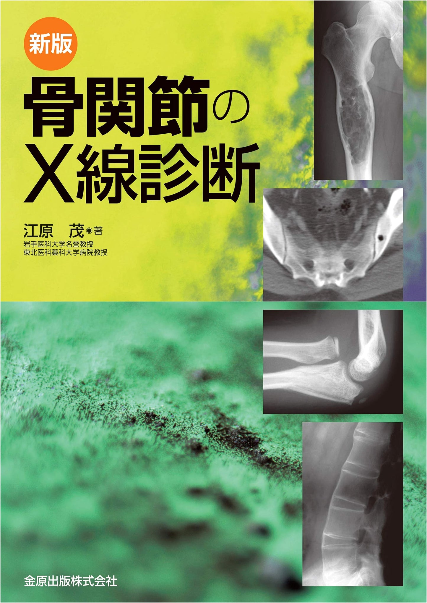 Revised Edition: X-ray Diagnosis of Bones and Joints