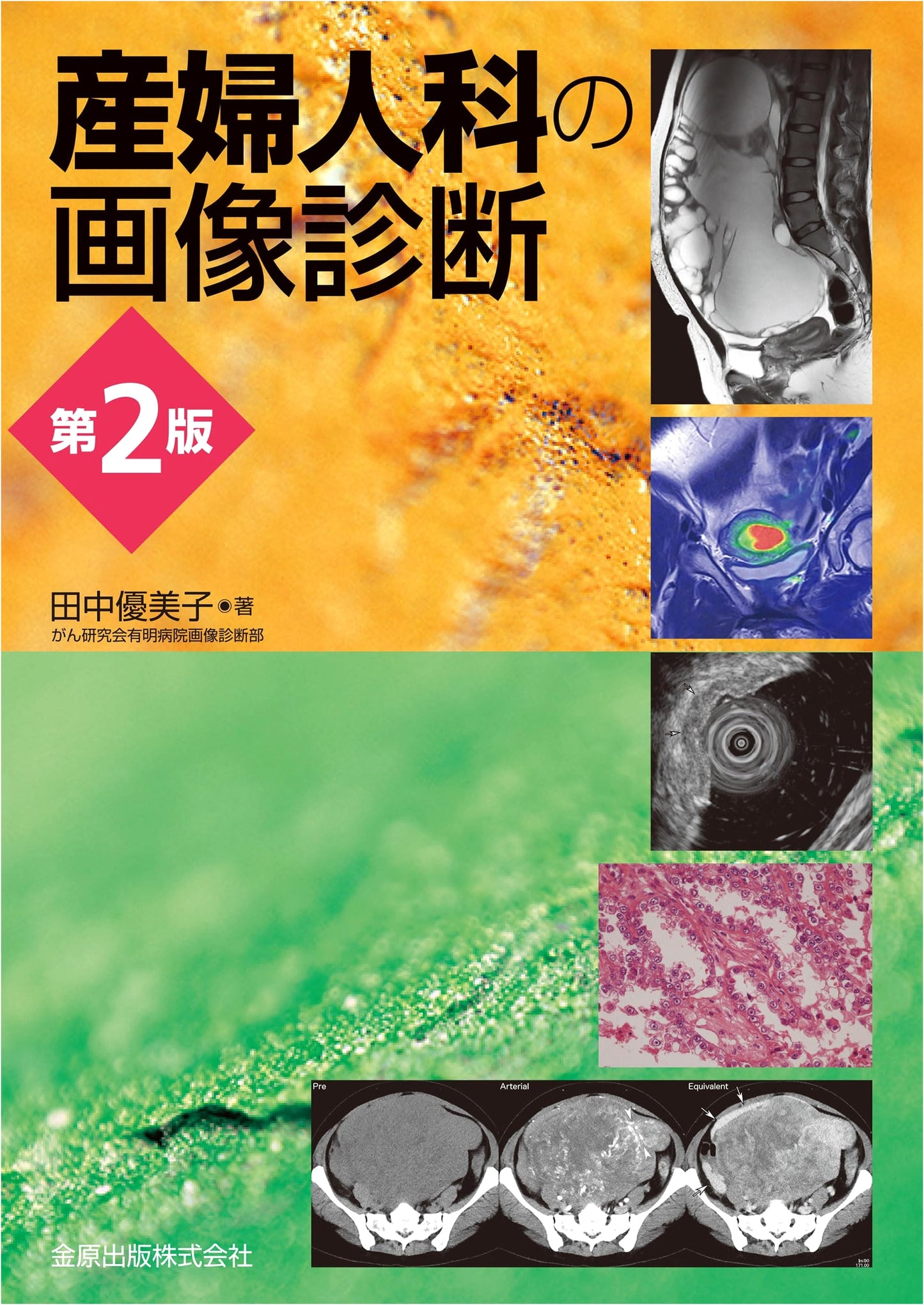 Diagnostic Imaging in Obstetrics and Gynecology, 2nd Edition, by Yumiko Tanaka