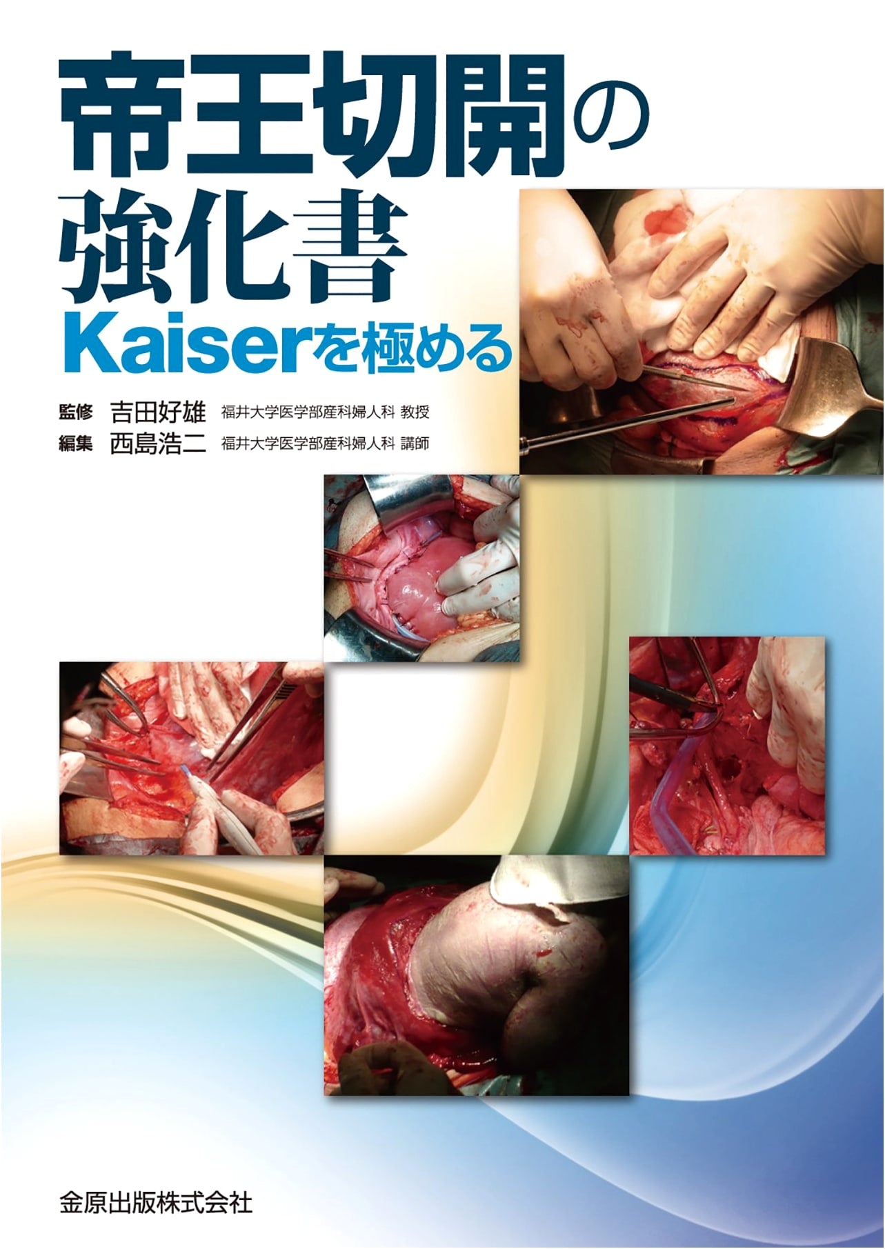 Mastering Cesarean Section: The Kaiser's Textbook