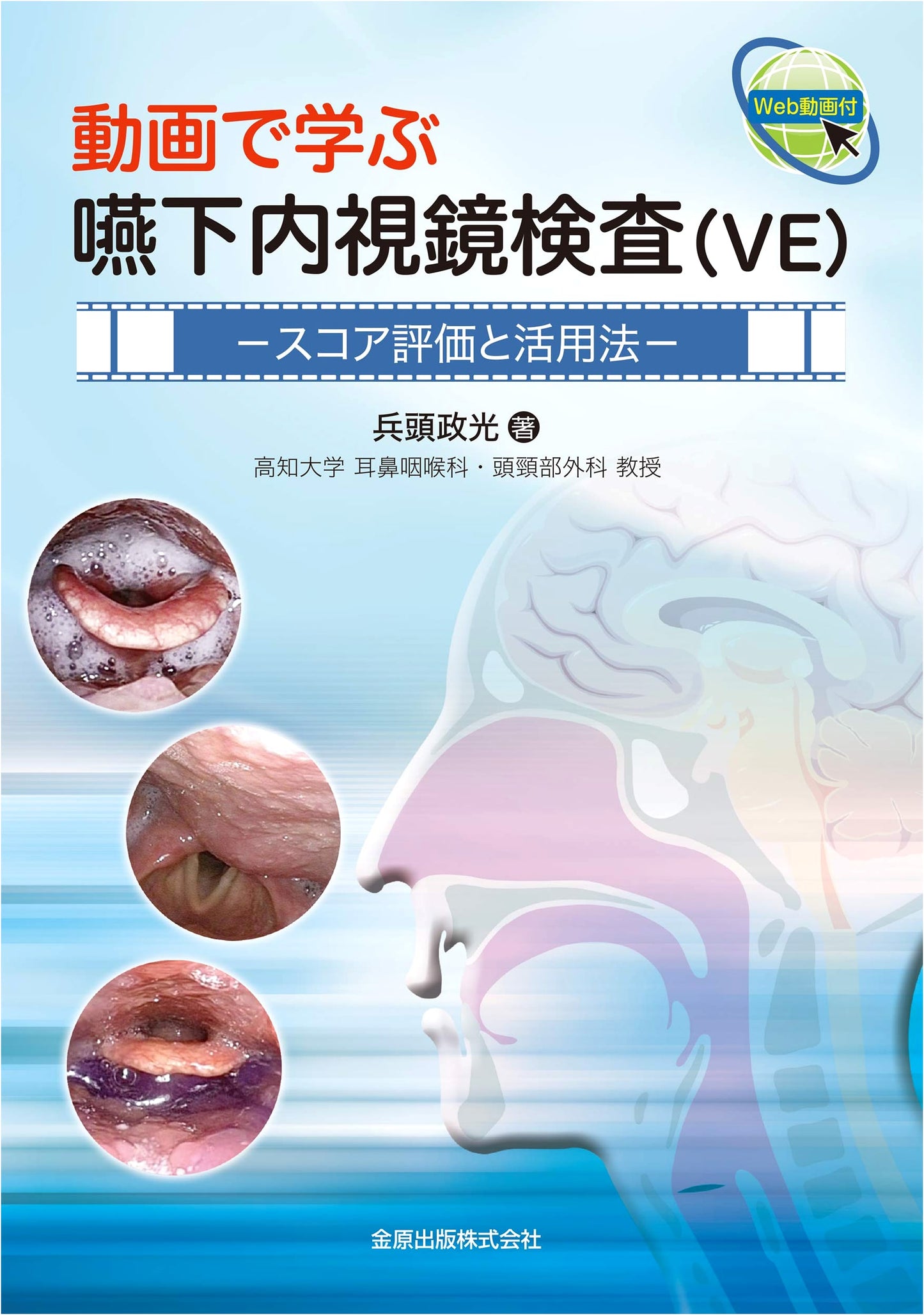 Video-Guided Swallowing Endoscopy (VE): Score Evaluation & Practical Application
