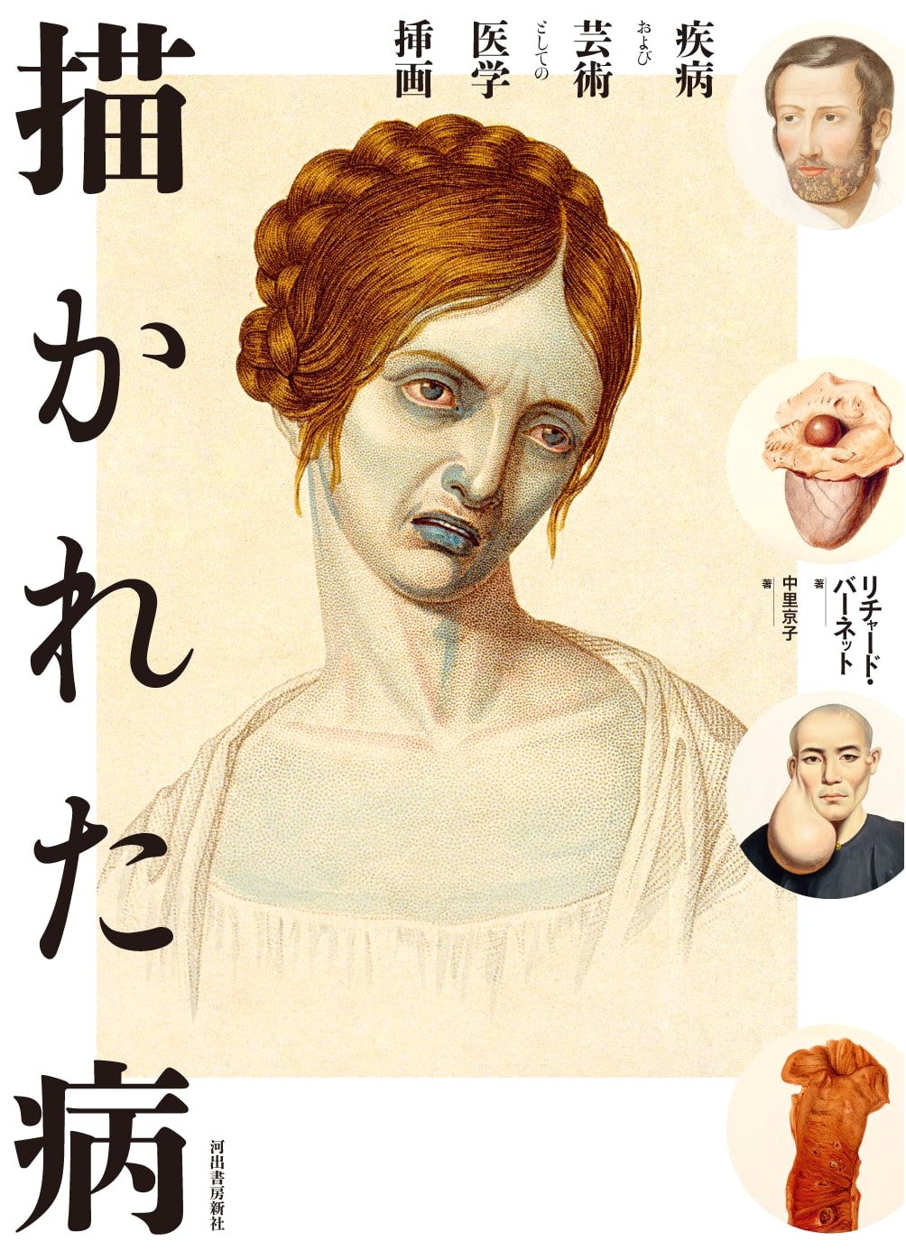 Painted Illness: Disease and Medical Illustration as Art by Richard Barnett
