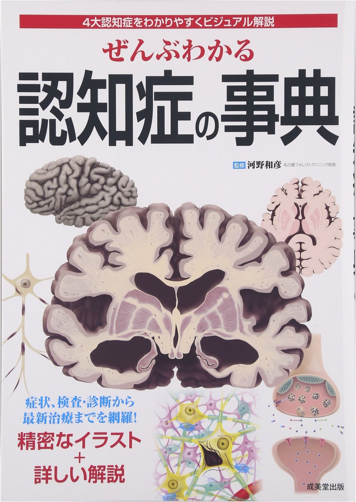 The Complete Dementia Encyclopedia: Visual Guide to the Four Major Types
