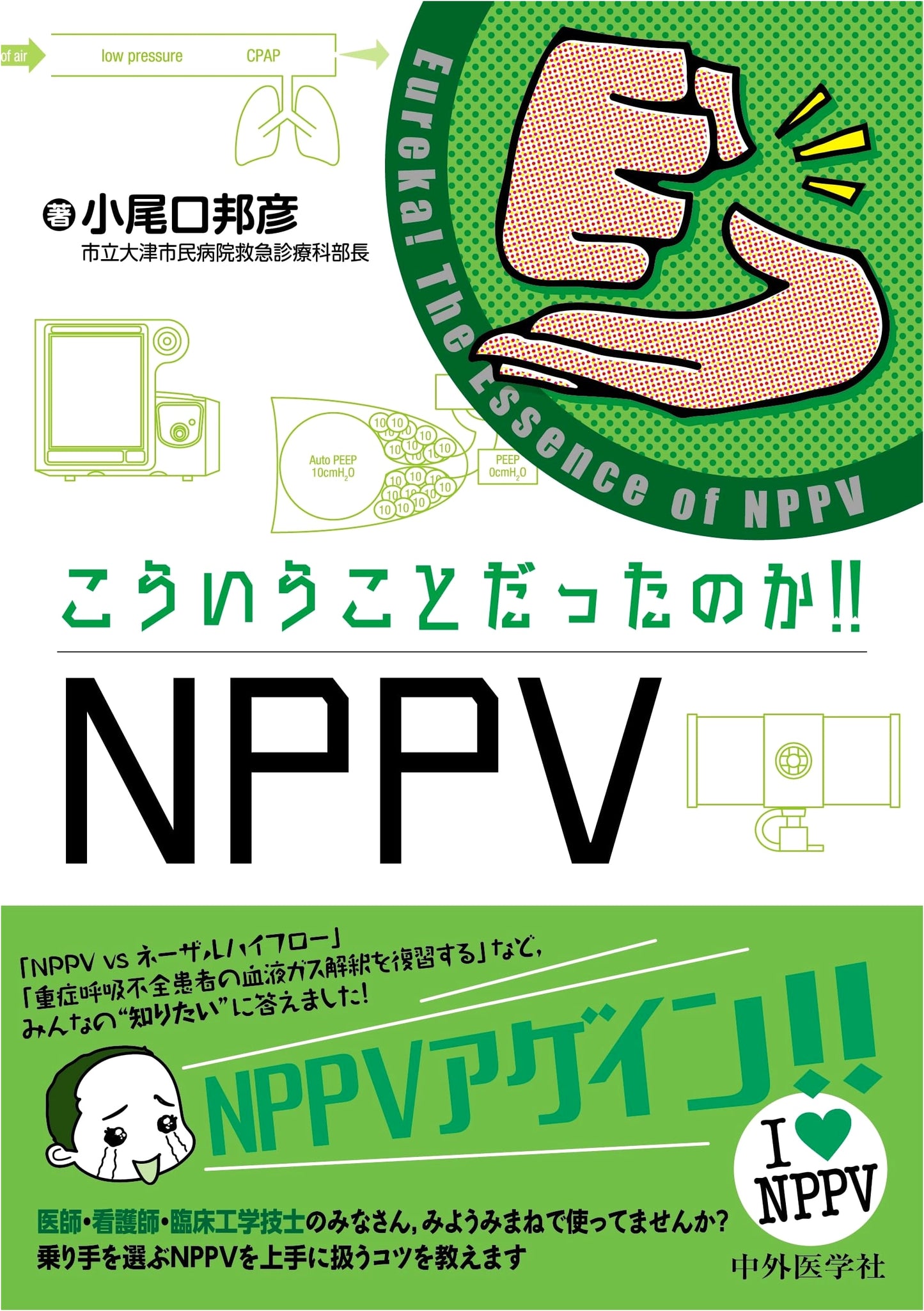 Unlocking NPPV: The 'Aha!' Guide to Non-Invasive Positive Pressure Ventilation