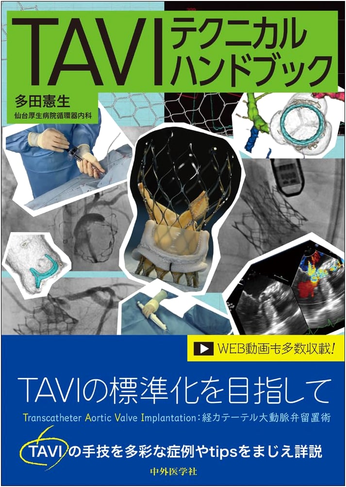 TAVI Technical Handbook