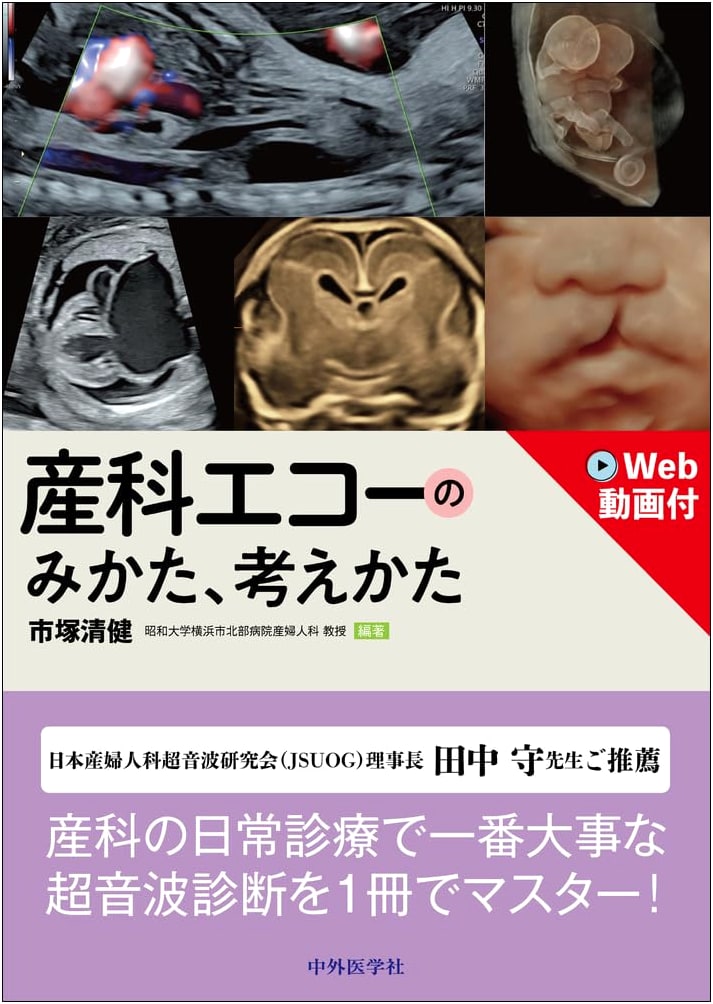 Obstetric Ultrasound: Views and Interpretations