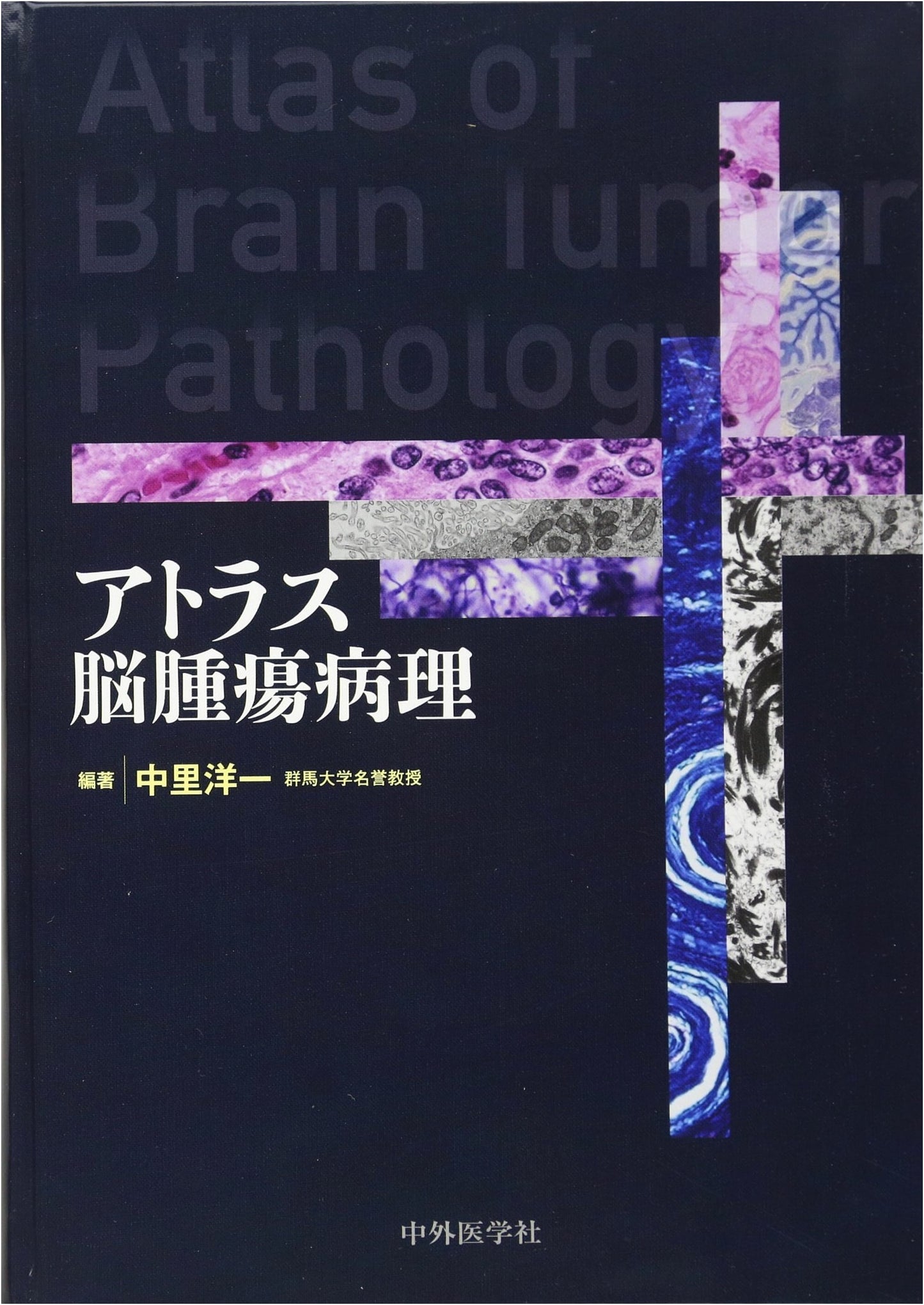 Atlas of Brain Tumor Pathology
