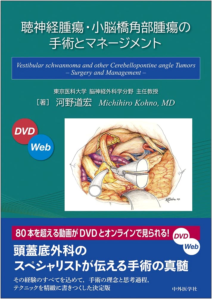 Surgery and Management of Acoustic Neuroma and Cerebellopontine Angle Tumors