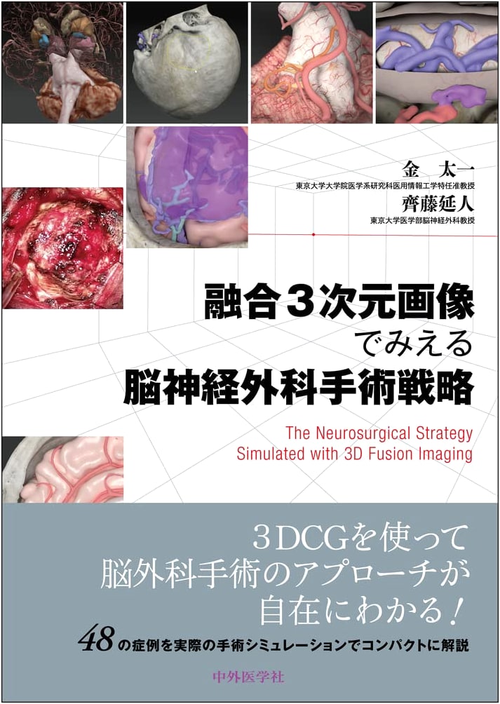 Neurosurgical Strategies: Visualizing with Fused 3D Imaging