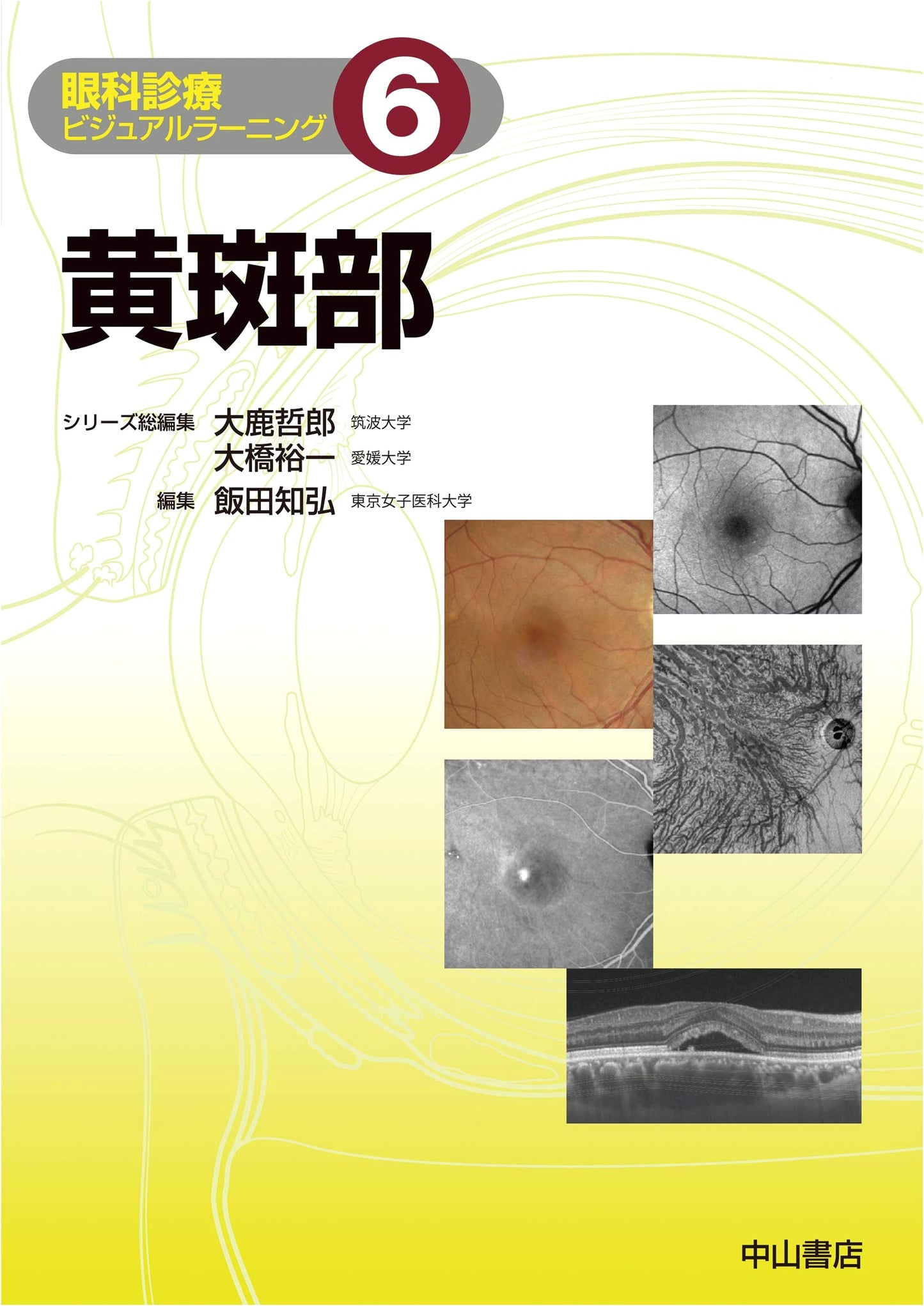Macular Region: Visual Learning in Ophthalmic Clinical Practice