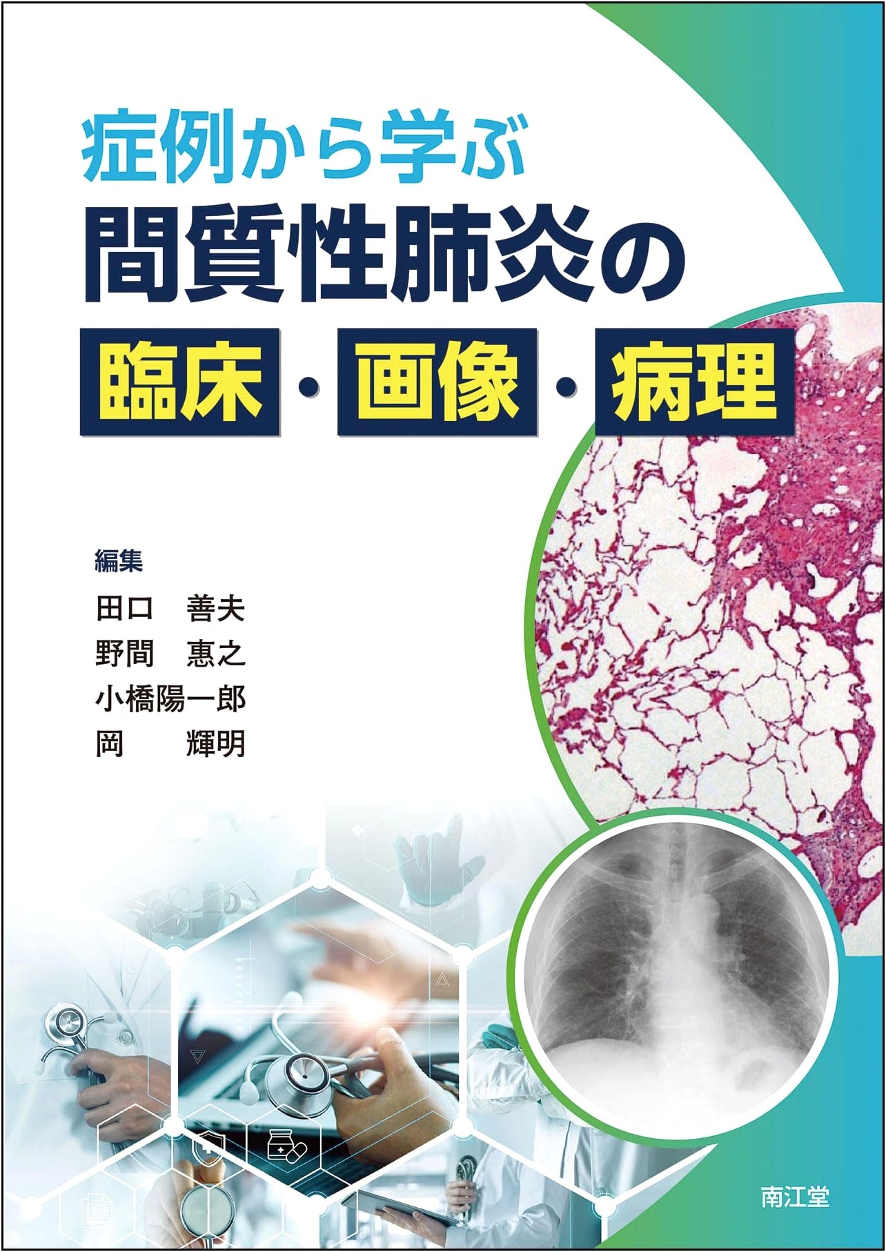 Clinical, Imaging, and Pathology of Interstitial Pneumonia: Learning from Cases