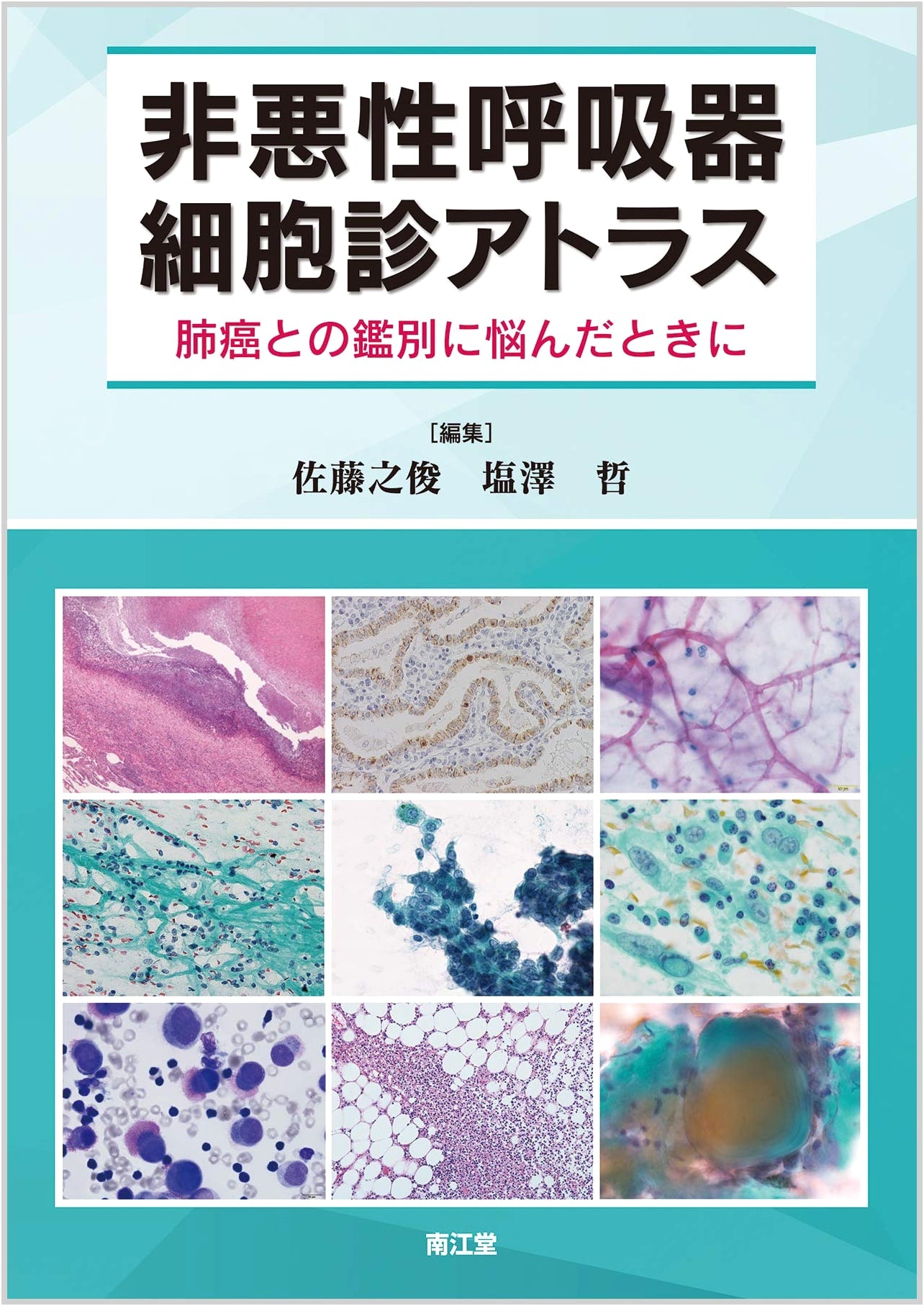 Atlas of Non-Malignant Respiratory Cytology: When Distinguishing from Lung Cancer