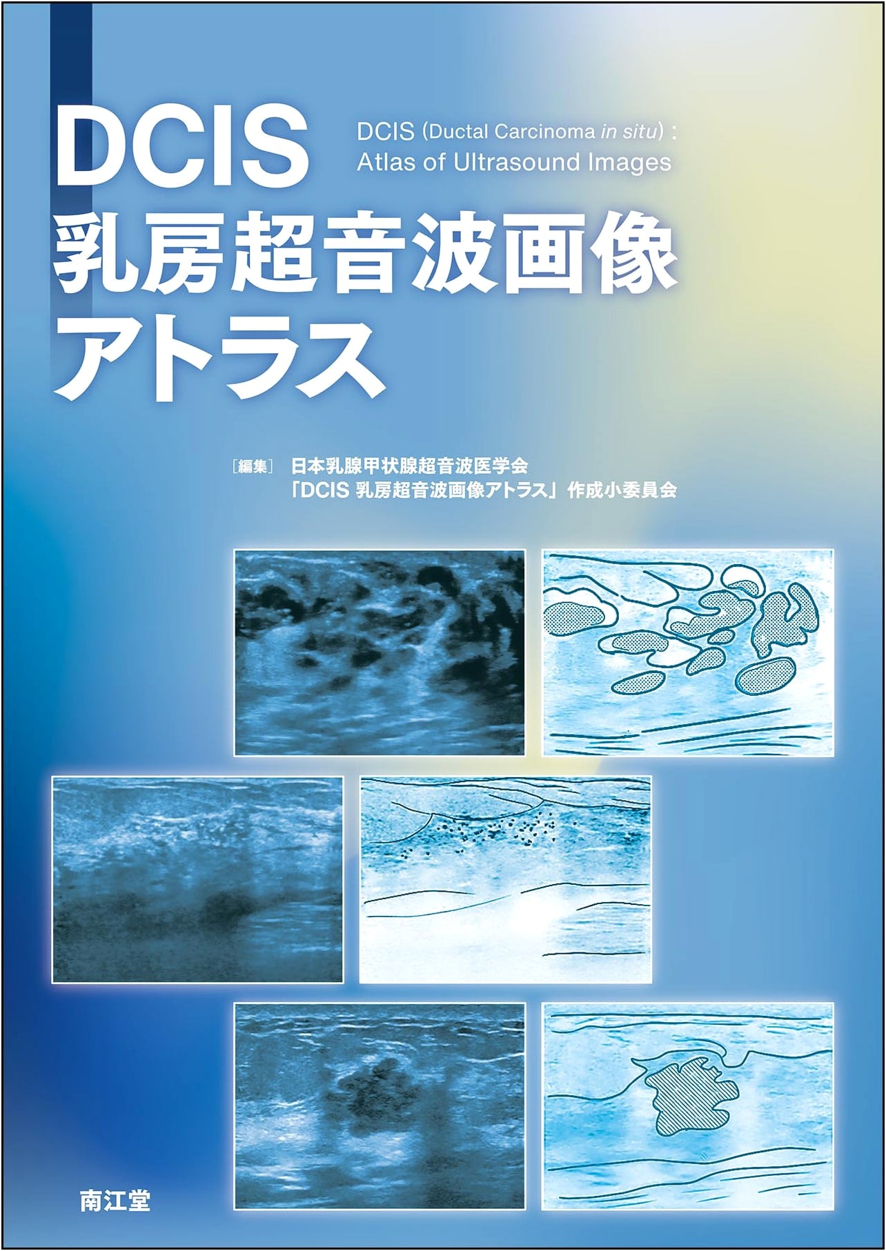 DCIS Breast Ultrasound Image Atlas