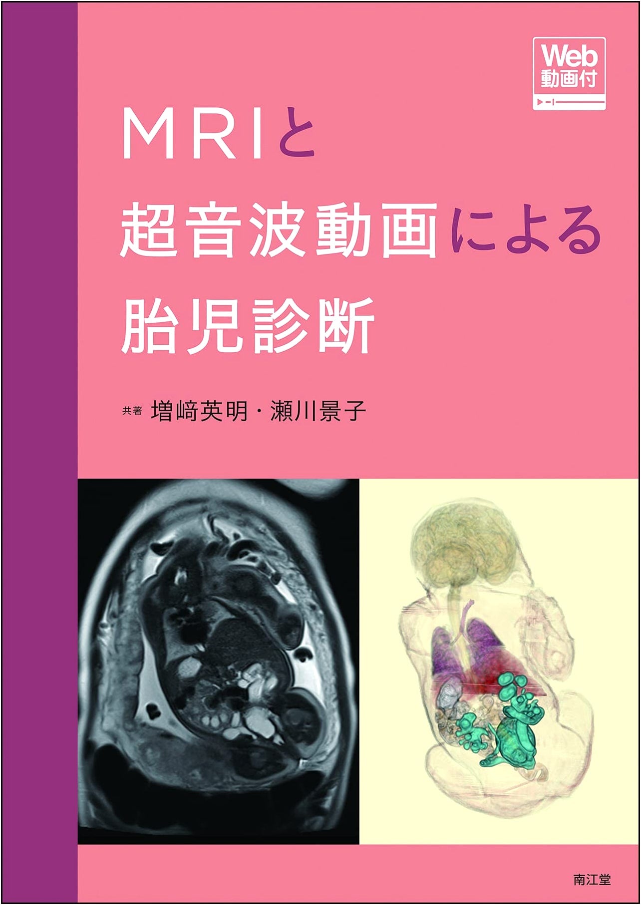 Fetal Diagnosis with MRI and Ultrasound Video (with Web Videos) by Keiko Segawa