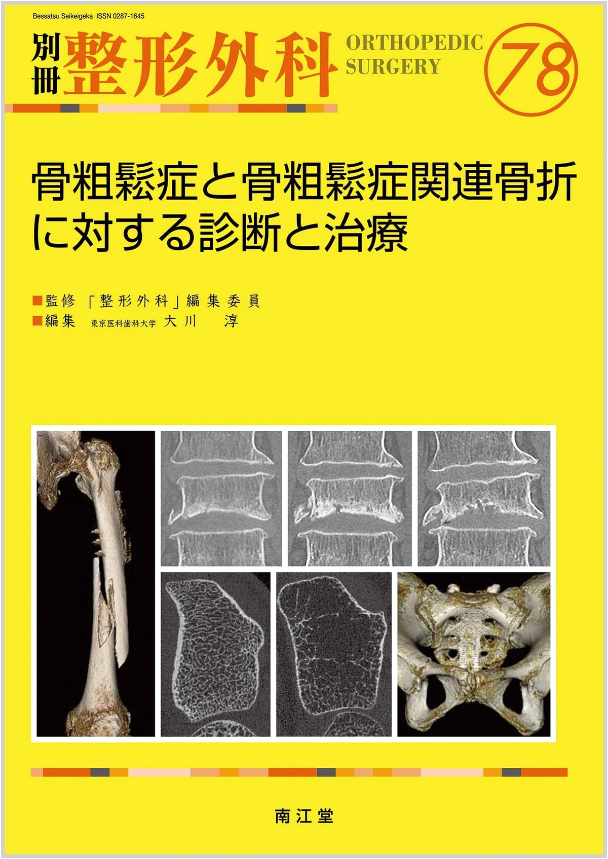 Diagnosis and Treatment for Osteoporosis and Related Fractures (Bessatsu Seikeigeka No.78)