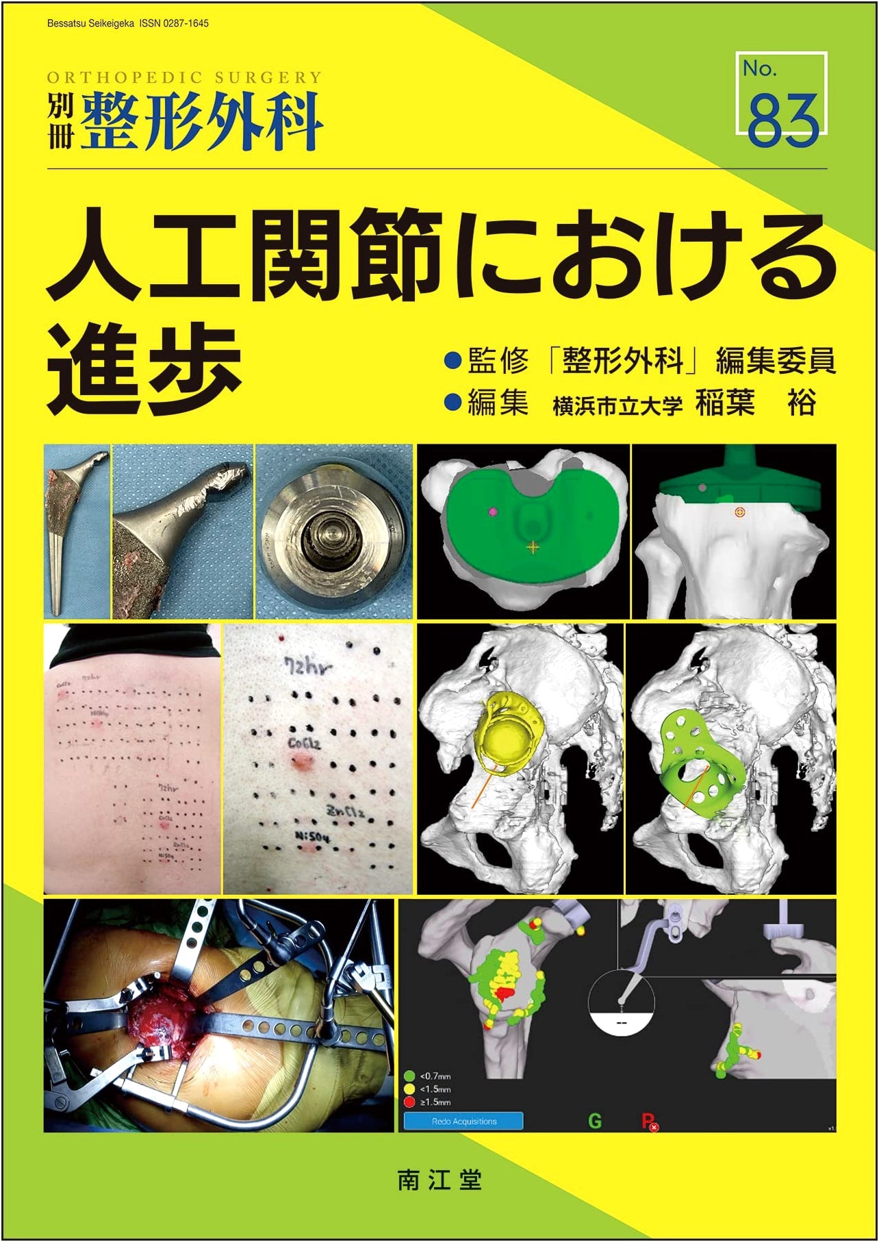 Advances in Artificial Joints (Orthopedics Supplement)