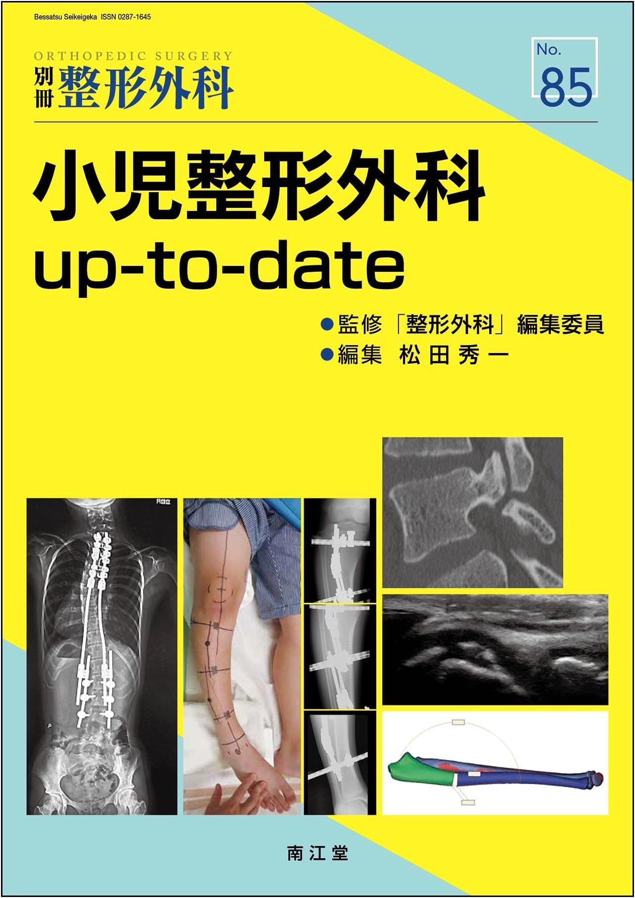 Pediatric Orthopedic Surgery Up-to-Date (Orthopedic Surgery Supplement No. 85)