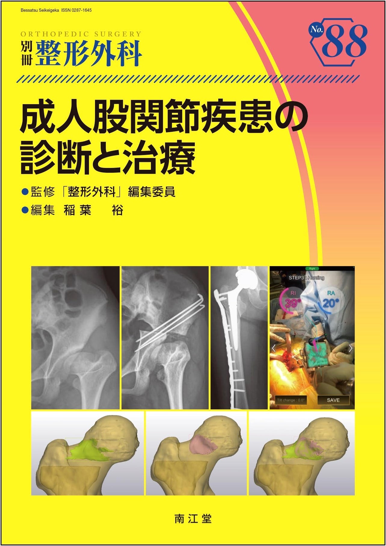Diagnosis and Treatment of Adult Hip Joint Diseases (Orthopedic Surgery Special Issue No. 88)