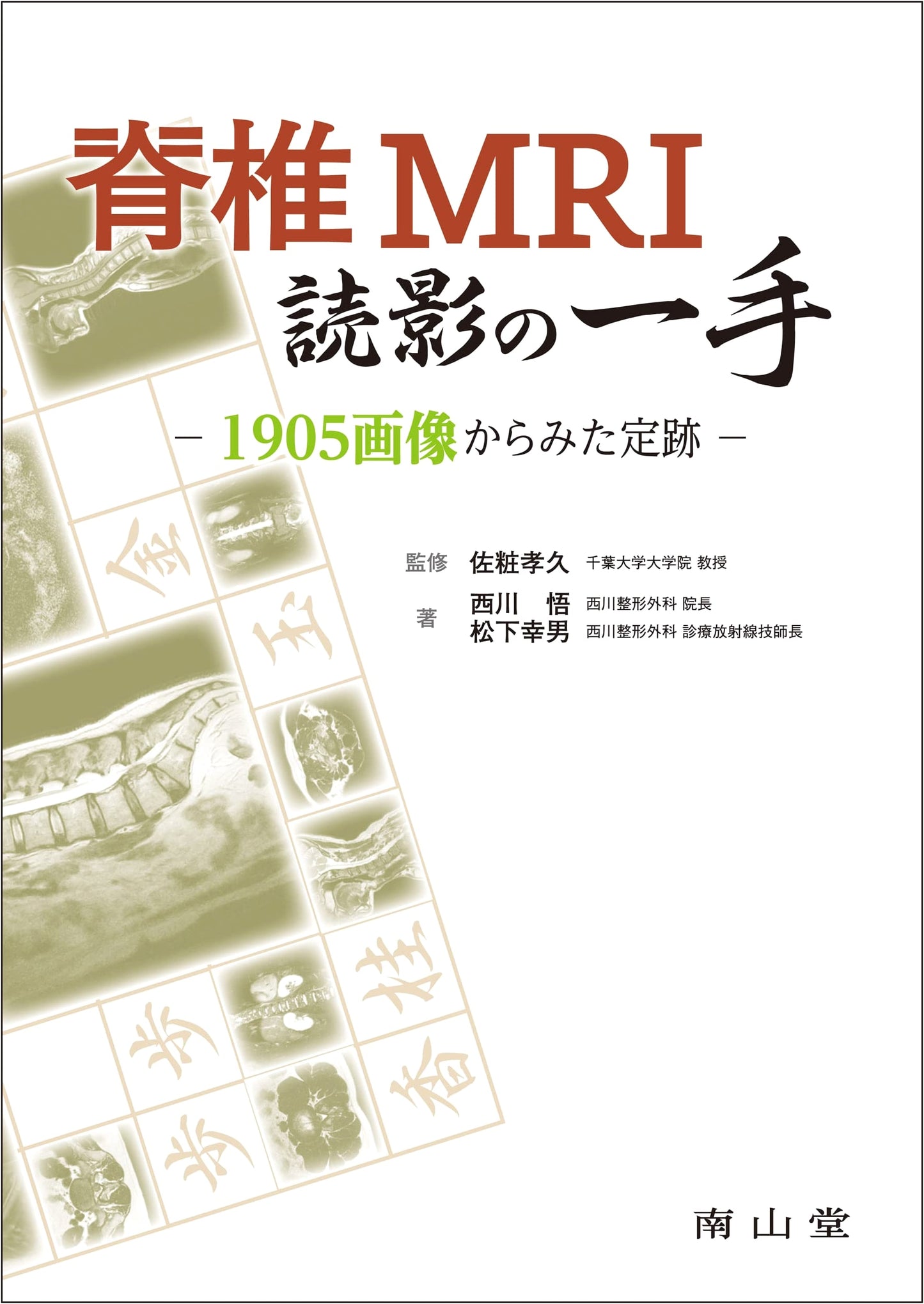Spinal MRI Interpretation: Strategic Approaches from 1905 Images