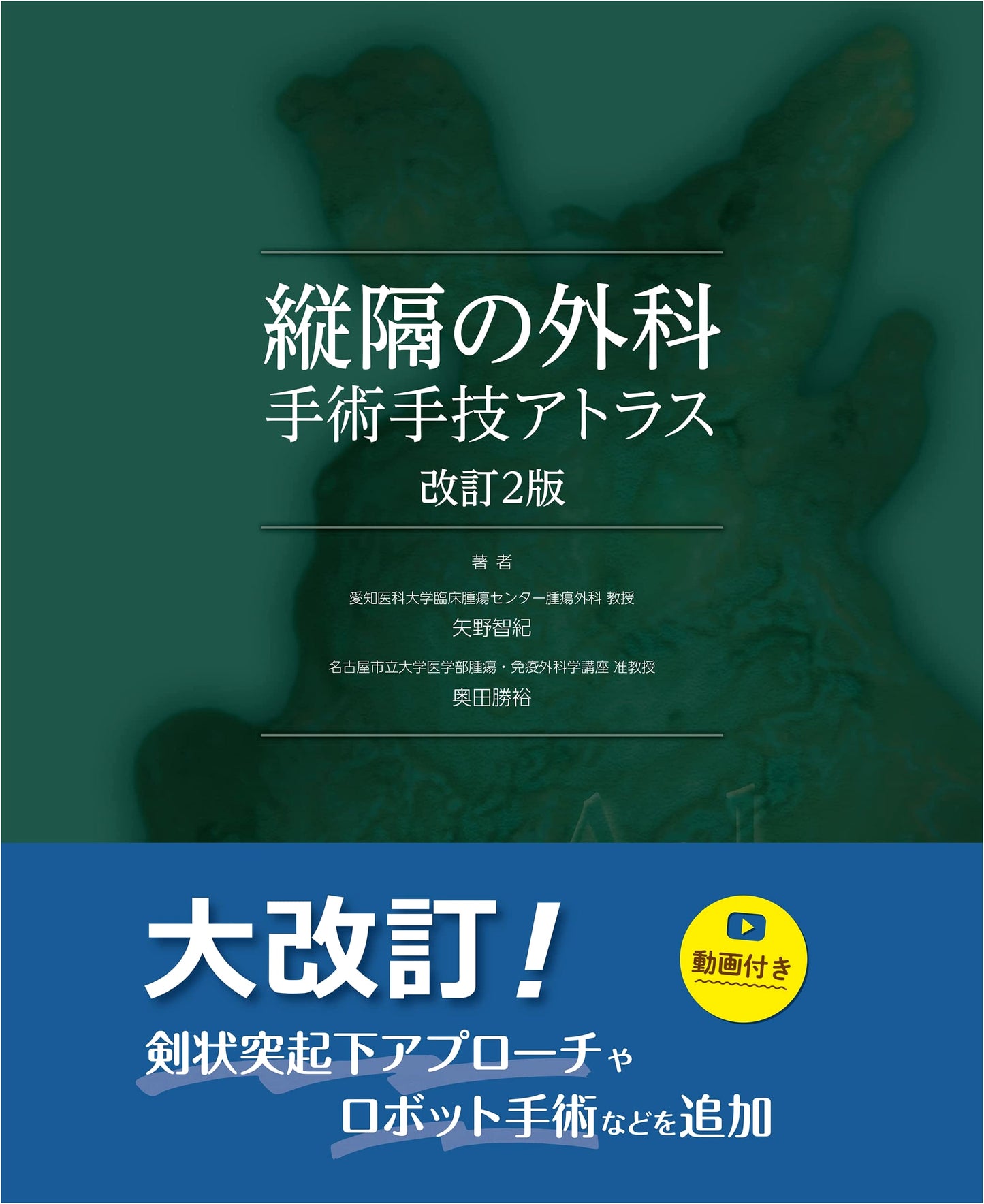 Surgery of the Mediastinum: An Atlas of Surgical Techniques