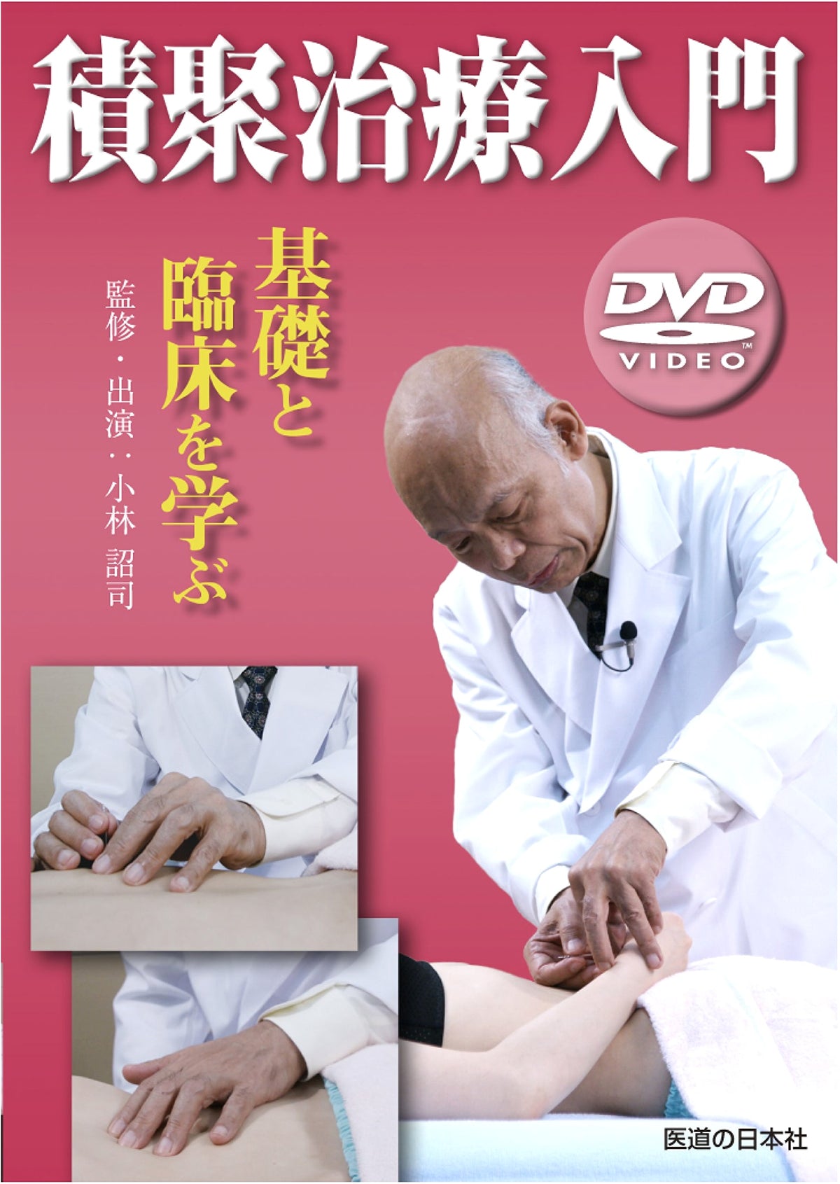 Sekijyu Treatment Introduction: Learning the Basics and Clinical Practice (DVD)