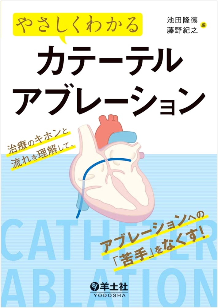 Understanding Catheter Ablation: Basics, Flow, and Overcoming Apprehension
