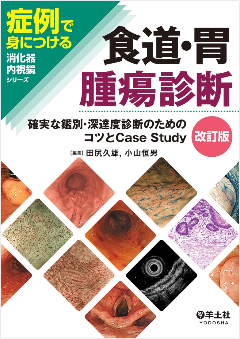 Revised Esophageal & Gastric Tumor Diagnosis: Tips & Case Studies for Accurate Differentiation