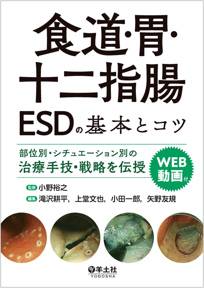 Esophagus, Stomach, Duodenum ESD: Fundamentals & Tips for Site-Specific Treatment