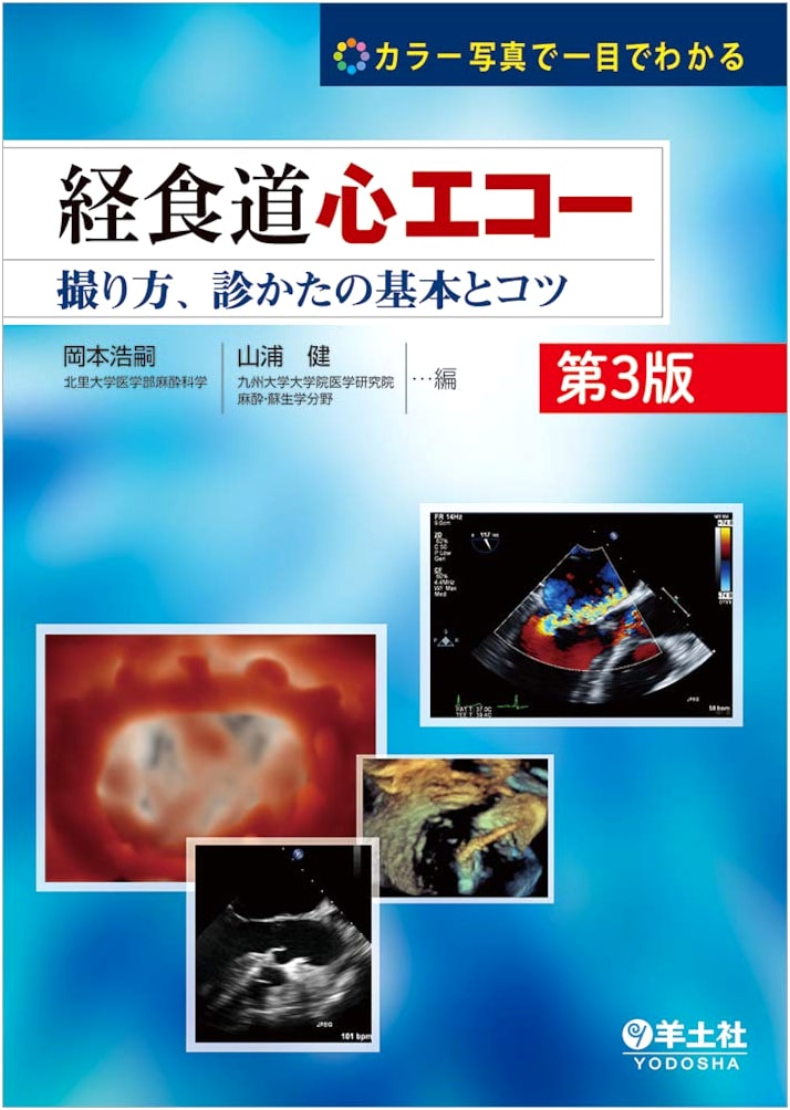 Transesophageal Echocardiography: 3rd Ed. Basics & Tips for Imaging and Diagnosis with Color Photos