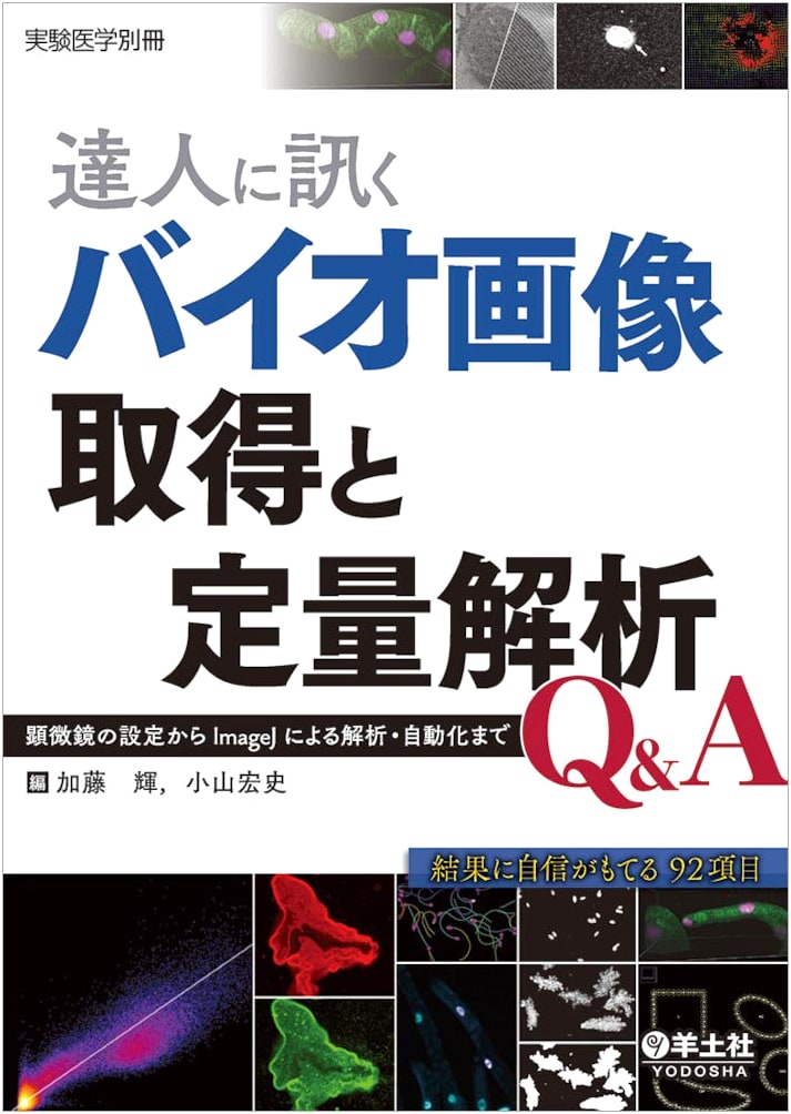 Ask the Experts: Bioimage Acquisition & Quantitative Analysis Q&A - From Microscopy Settings to ImageJ Analysis & Automation