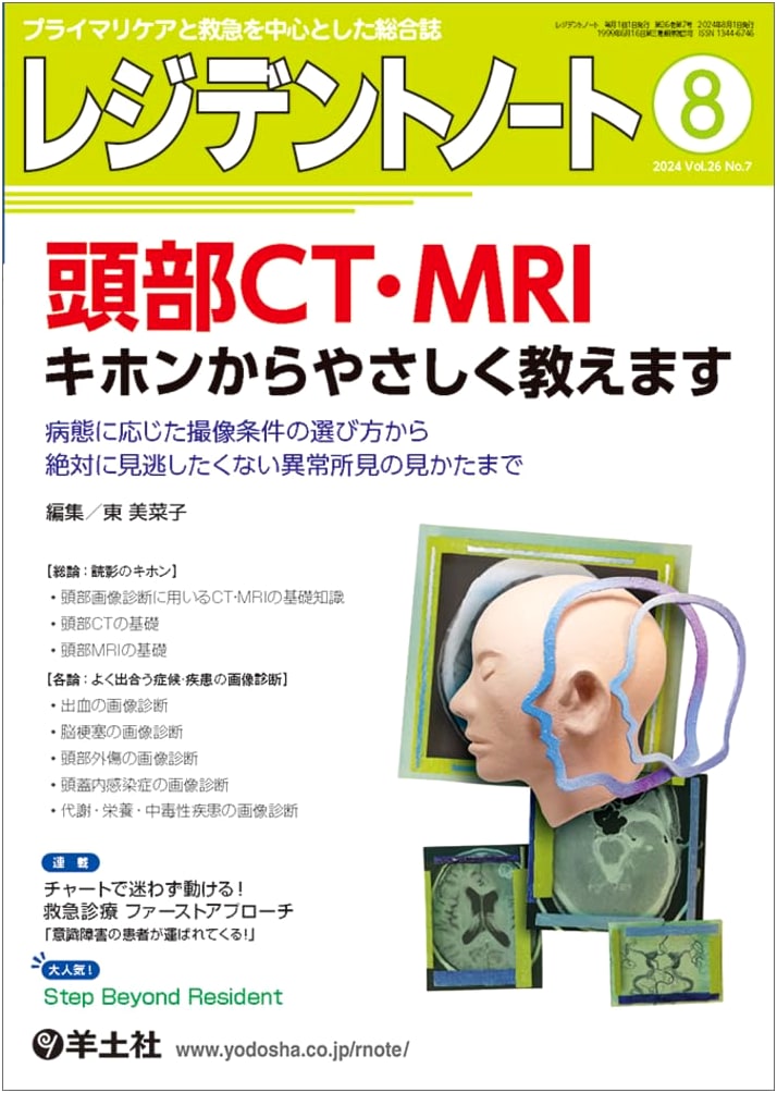 Resident Note Aug 2024, Vol.26 No.7: Head CT/MRI - From Basics to Crucial Findings