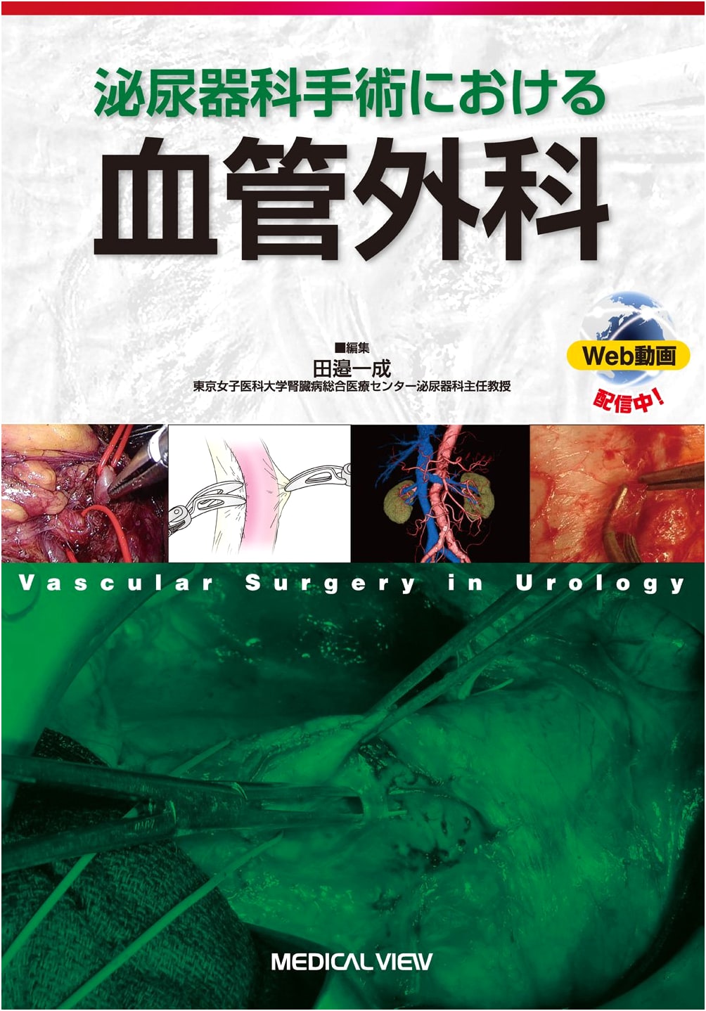 Vascular Surgery in Urological Operations