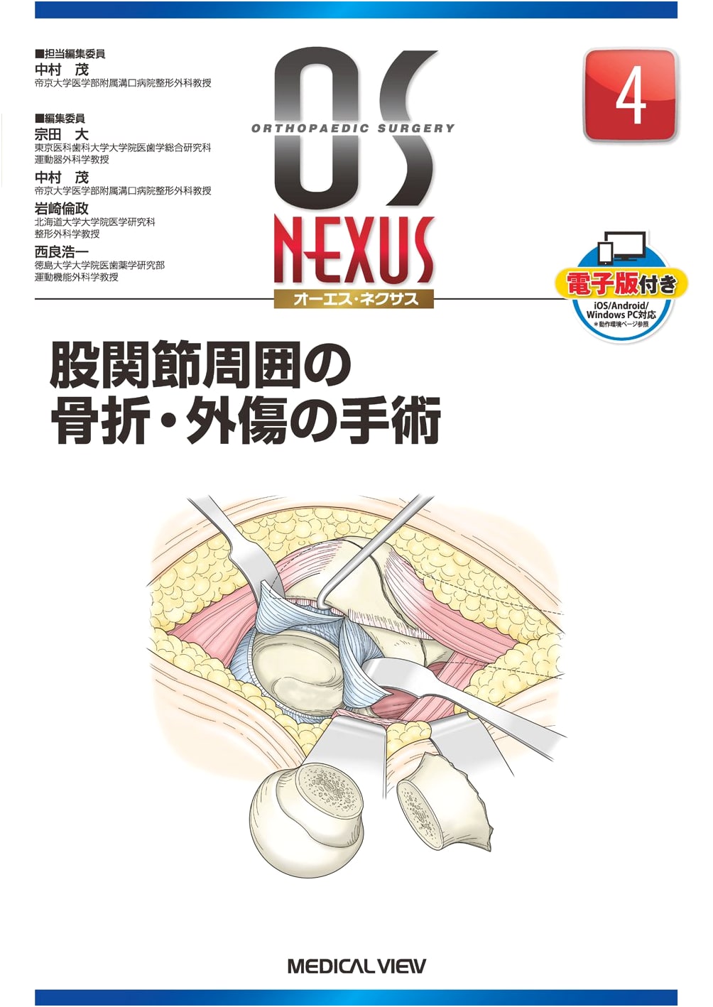 Surgery for Hip Fractures & Injuries: OS NEXUS Vol. 4 (with E-version)