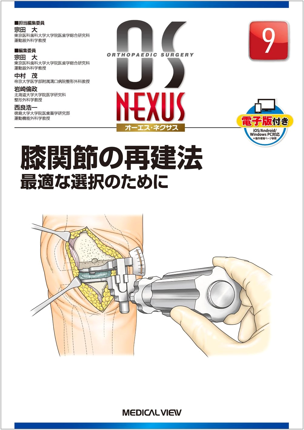 Knee Joint Reconstruction Methods: Optimal Selection (OS NEXUS 9)