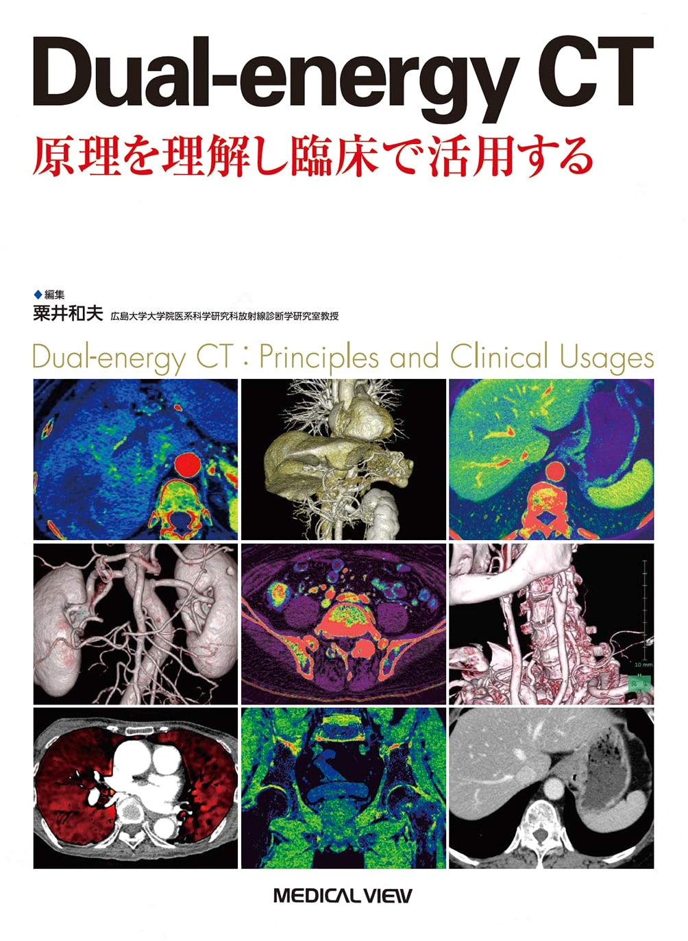 Dual-Energy CT: Understanding Principles and Clinical Applications